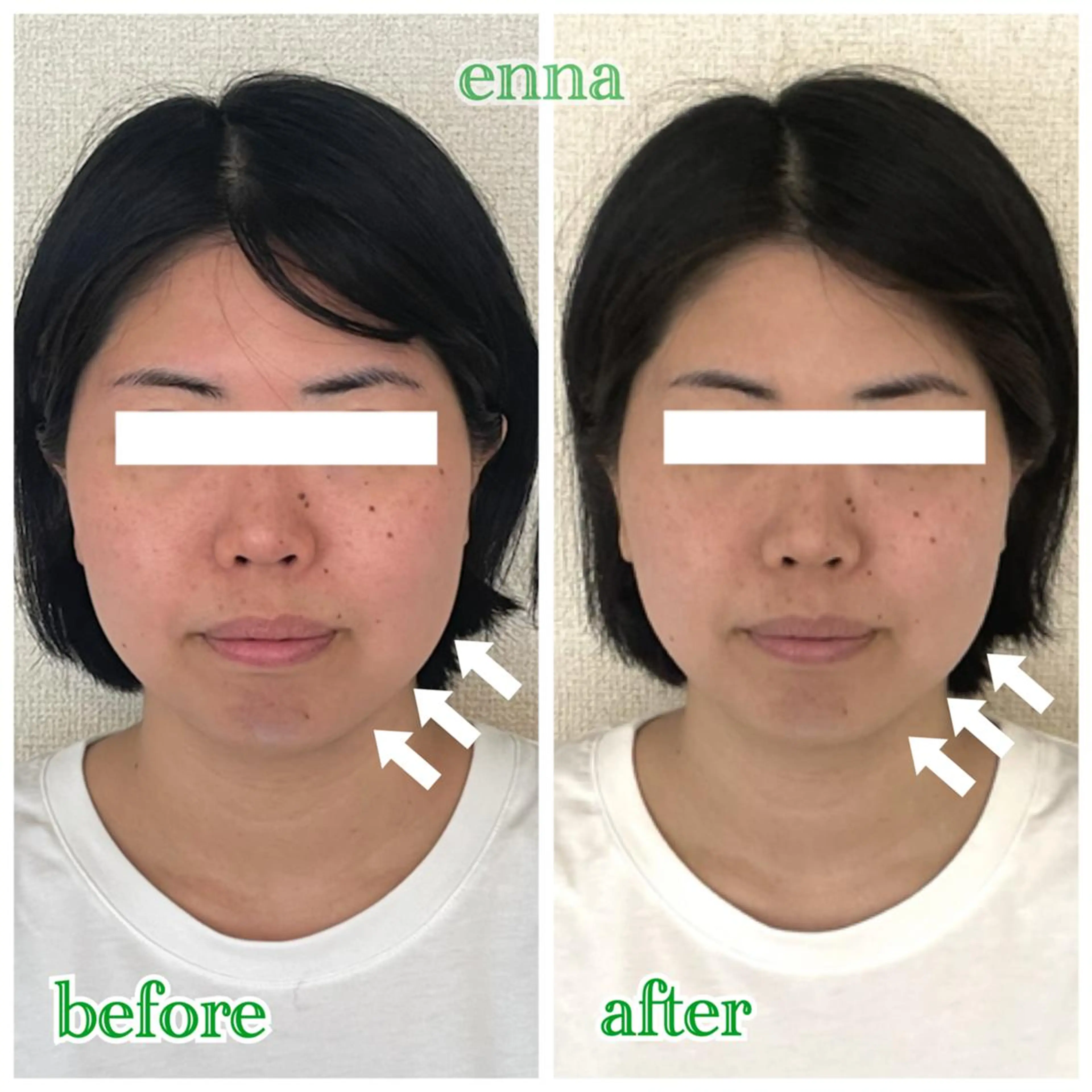 三上 笑里奈のエステ・リラクイメージ