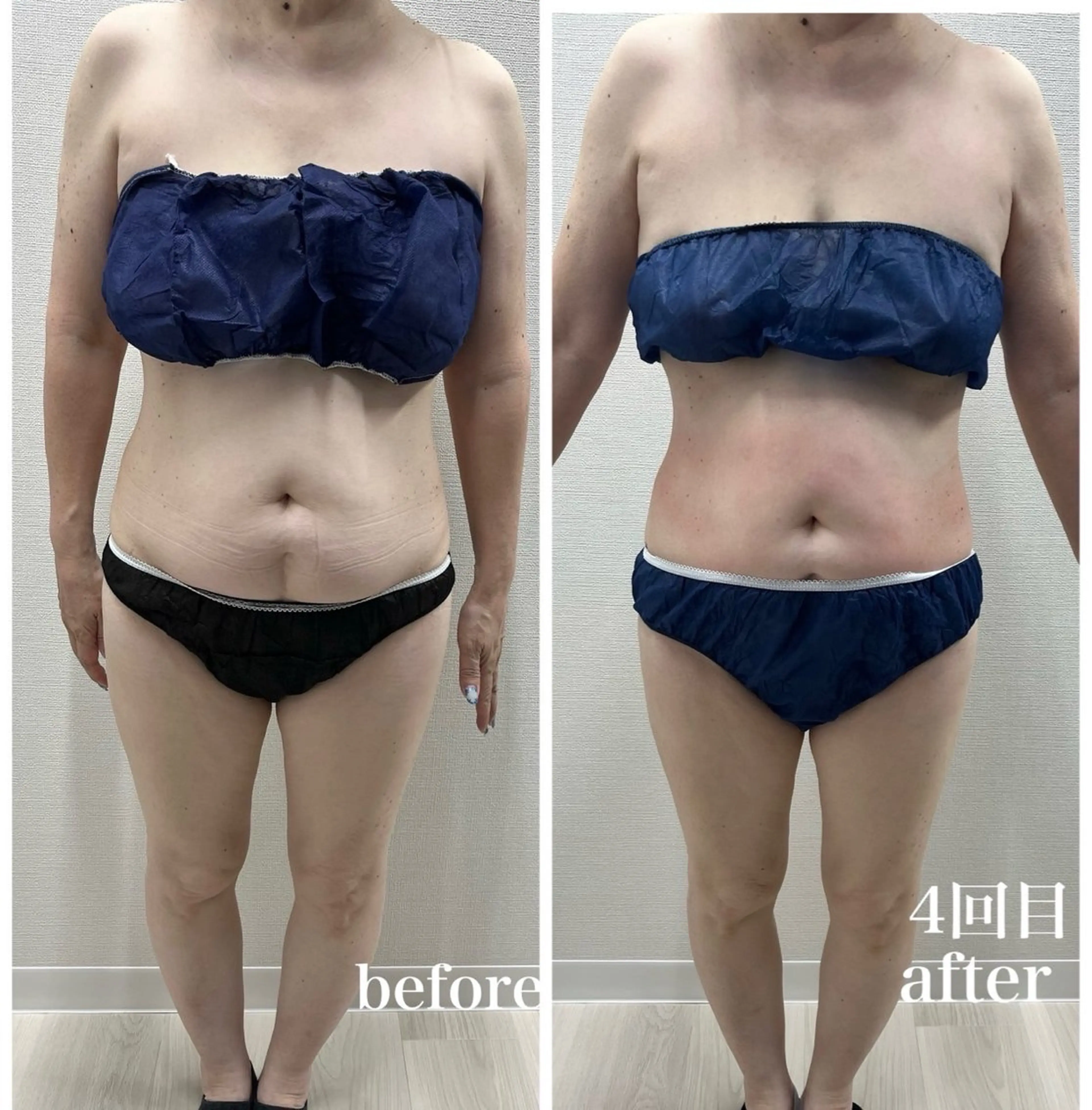 エステ Genesis Plus大津京店のエステ・リラクイメージ