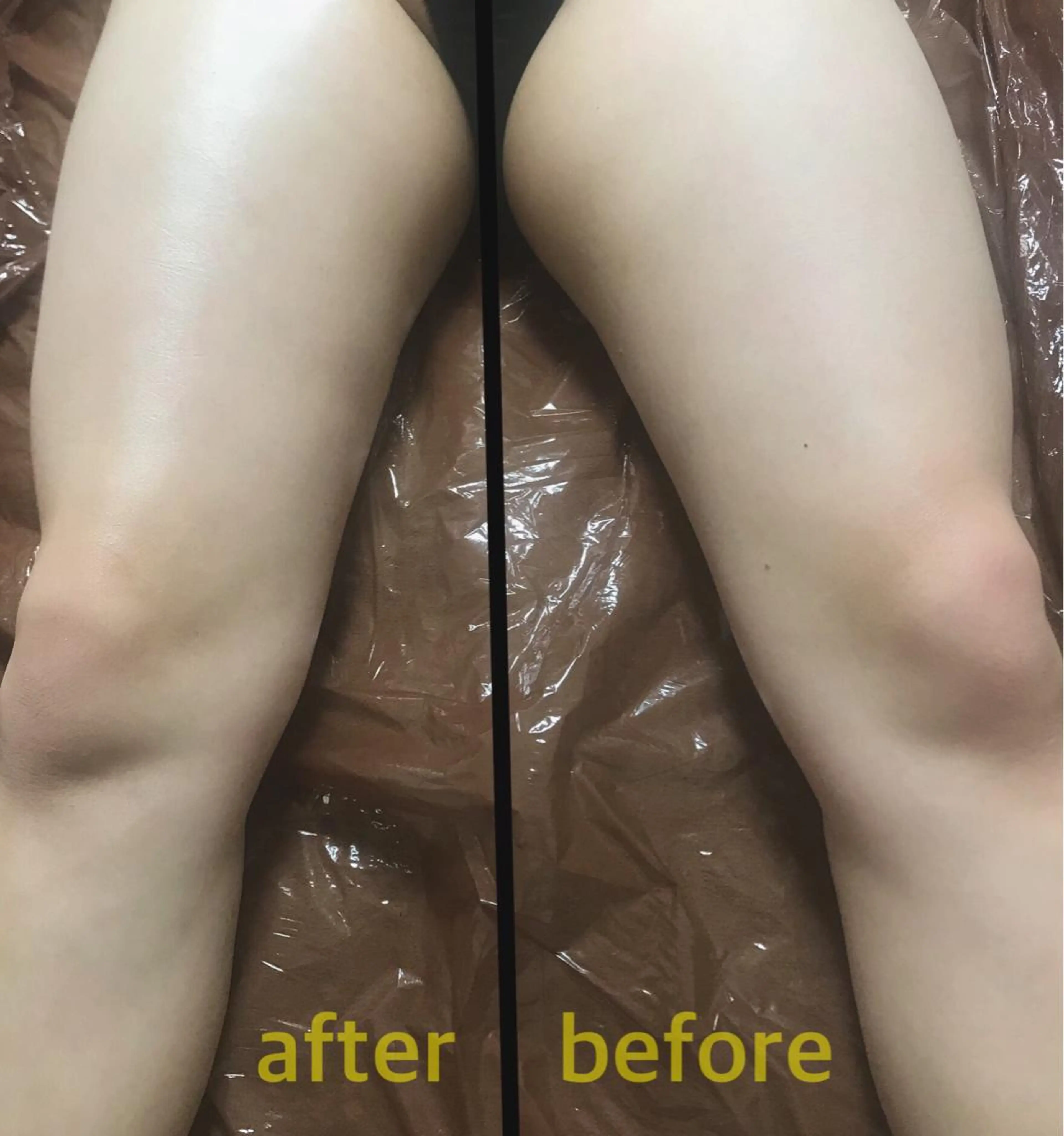 biloop所属・《痩身×疲労改善》 BILOOPのエステ・リラクイメージ