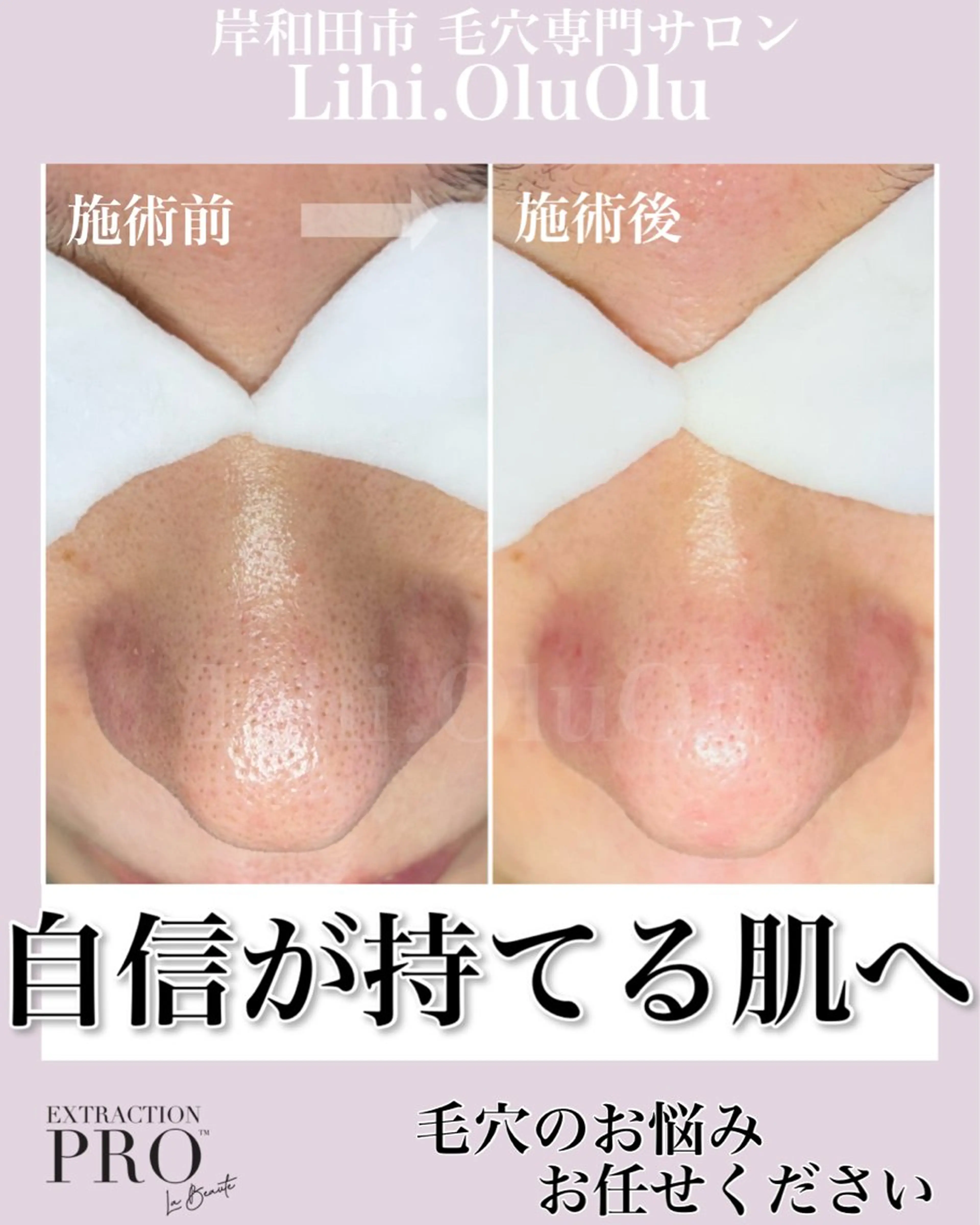 毛穴汚れ改善専門店/ 岸和田/リヒオルオルのエステ・リラクイメージ