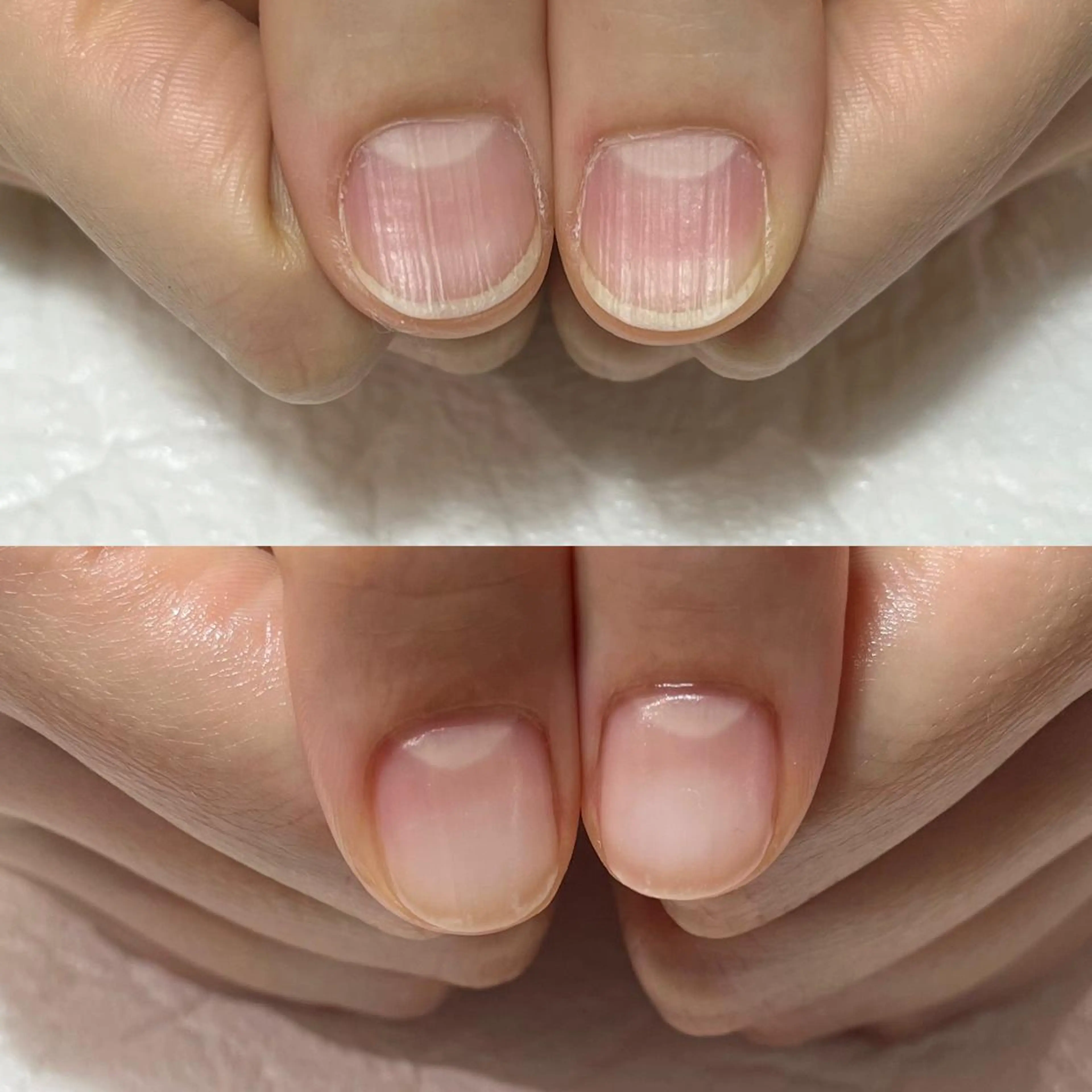 ネイル ジェルネイル 自爪育成・巻き爪 補正講師　津蔵のネイルデザイン