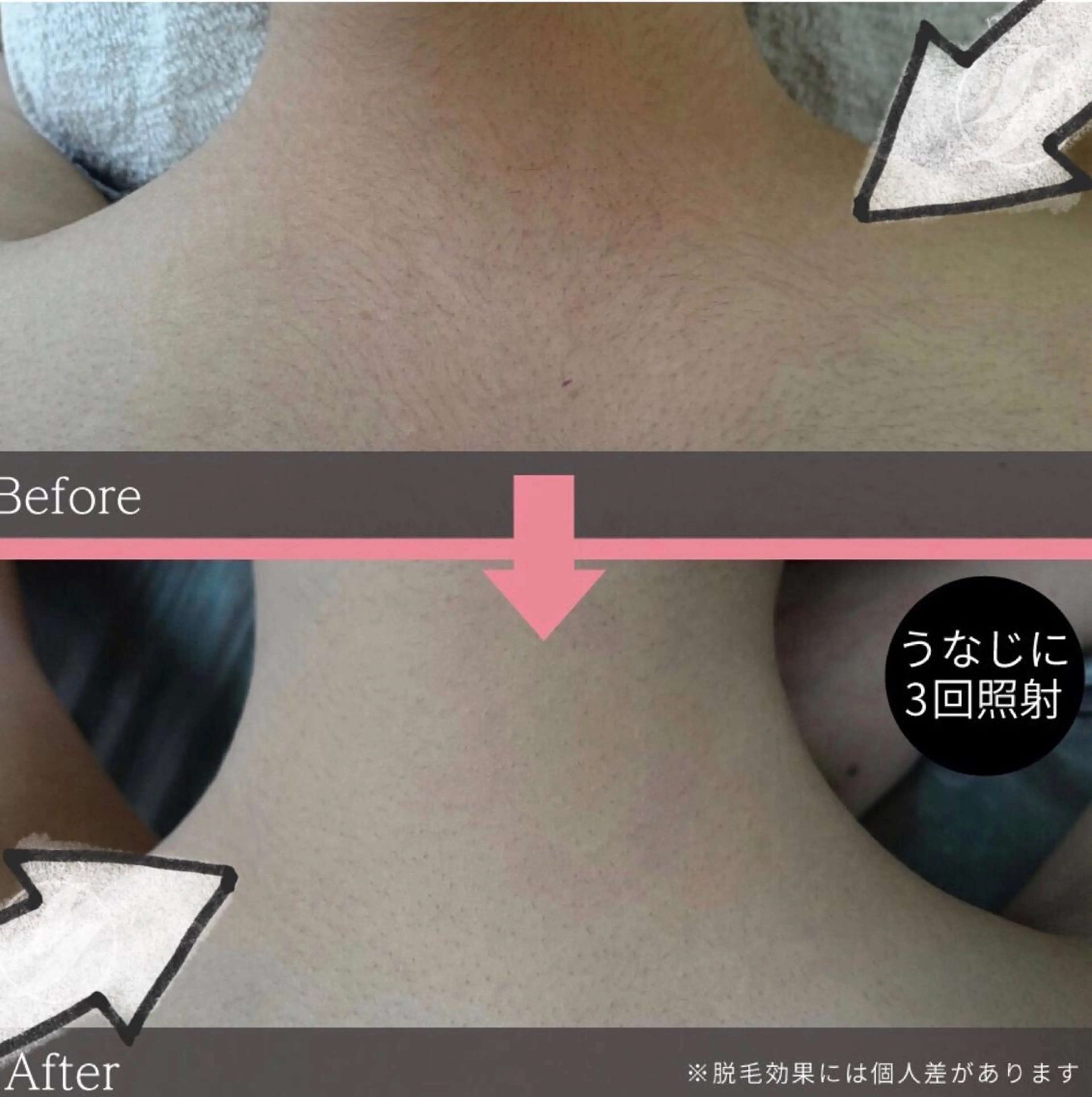 ..♡espoir 光脱毛♡..のエステ・リラクイメージ