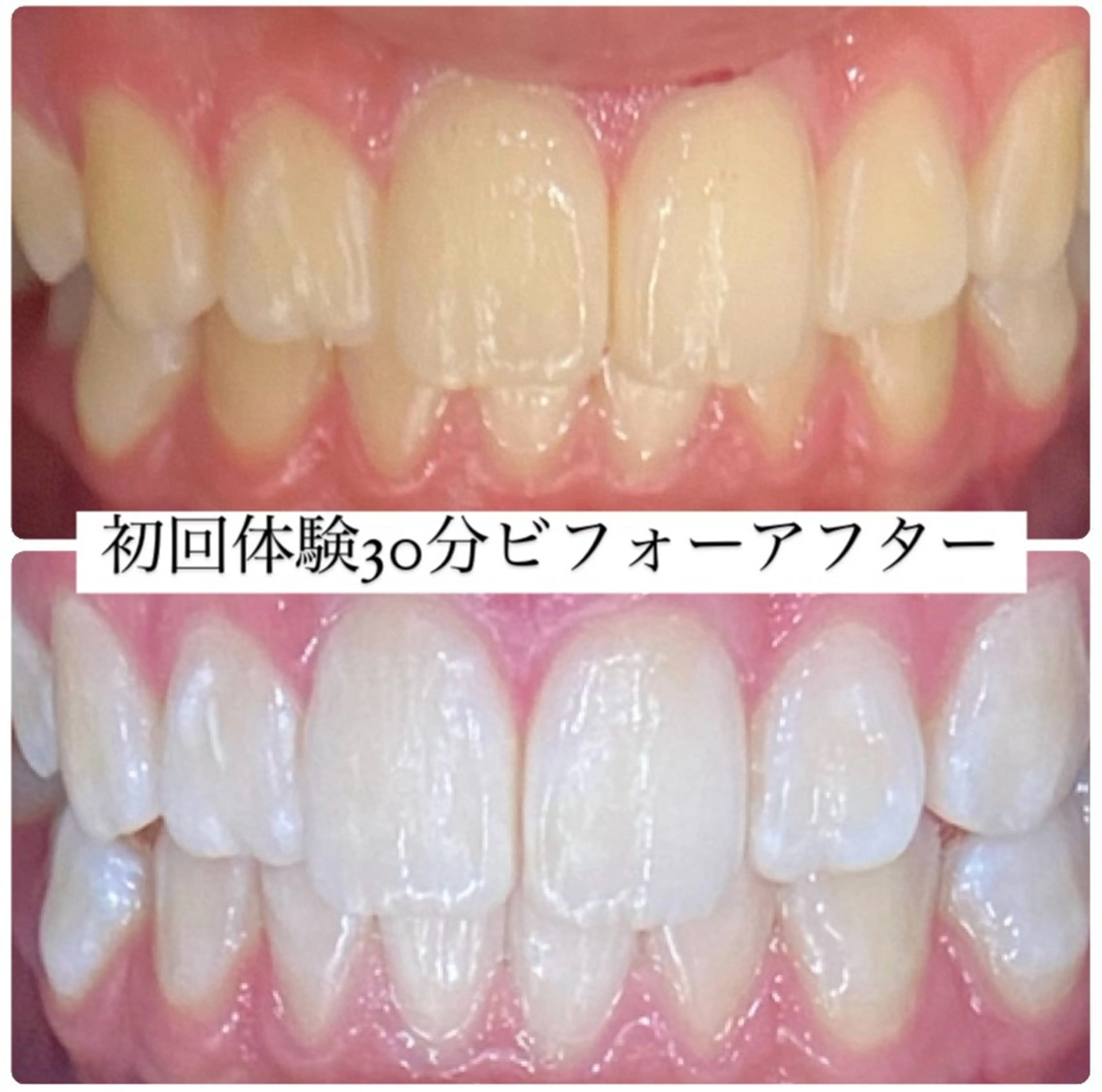 PLATINUM Beauty 横浜店所属・ホワイトニングルーム 横浜店のその他イメージ