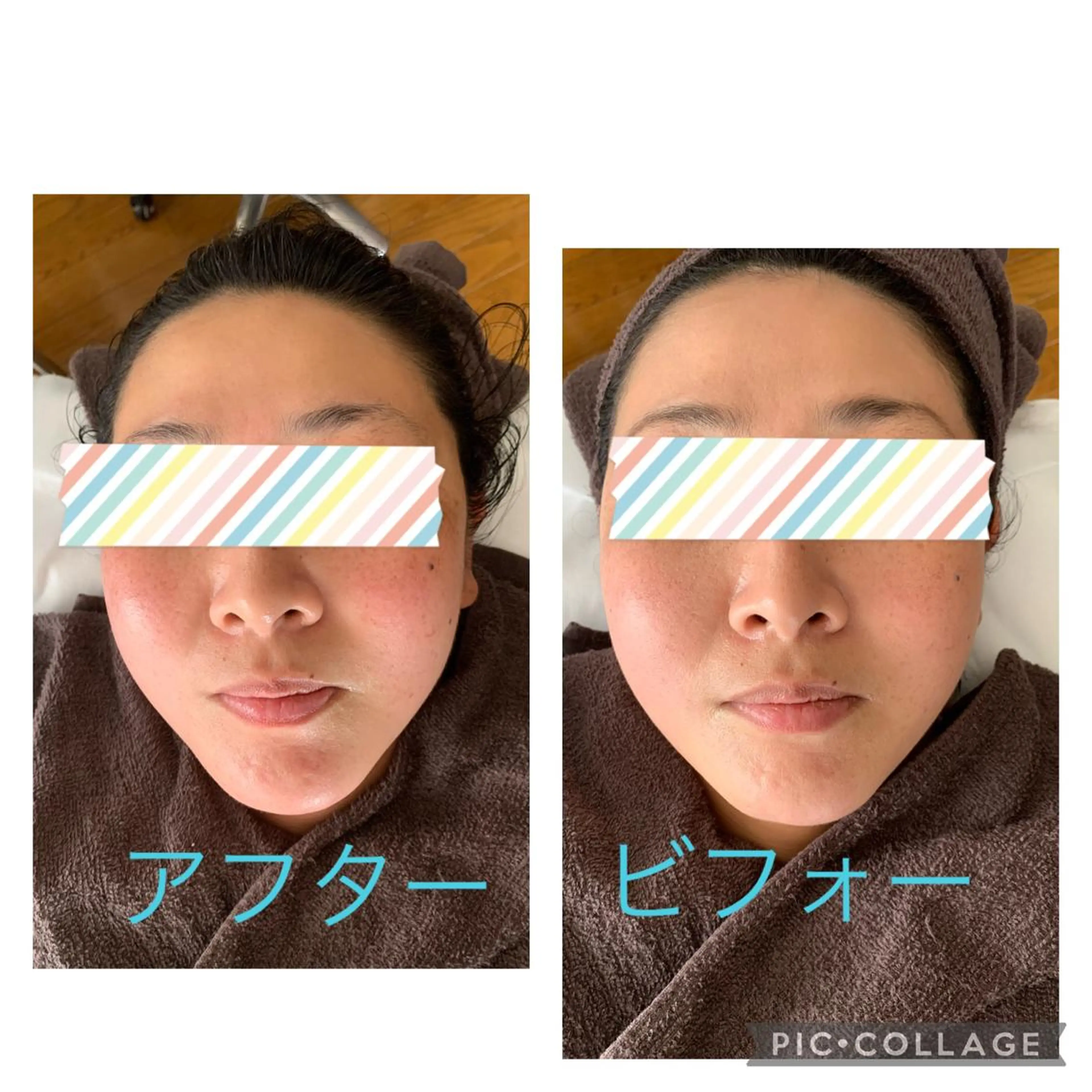 フェイシャルリラックスコースの写真