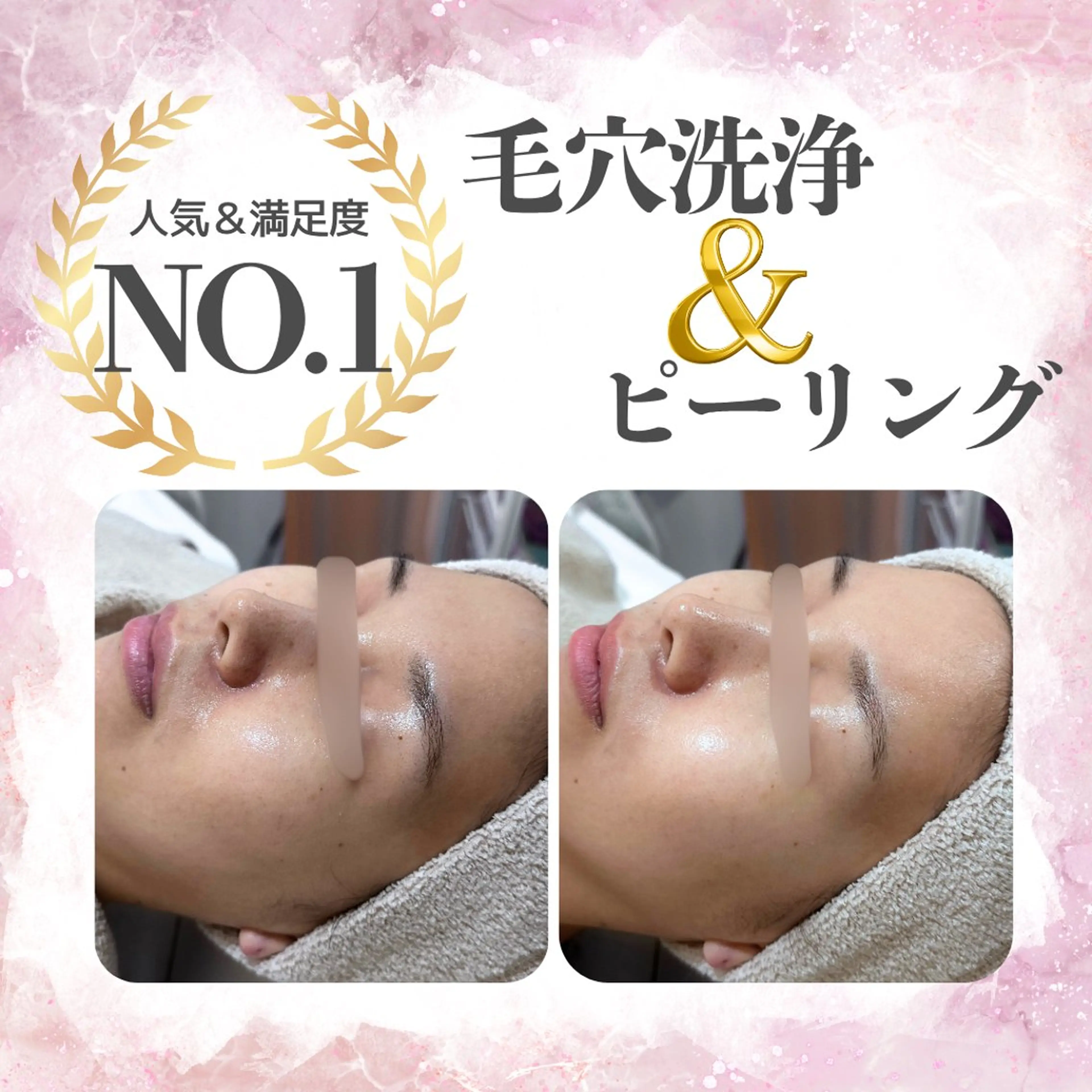 〈大人気🤍〉お好きなピーリング➕毛穴洗浄➕ドライヘッドスパ🫧〈平日価格💎〉の写真