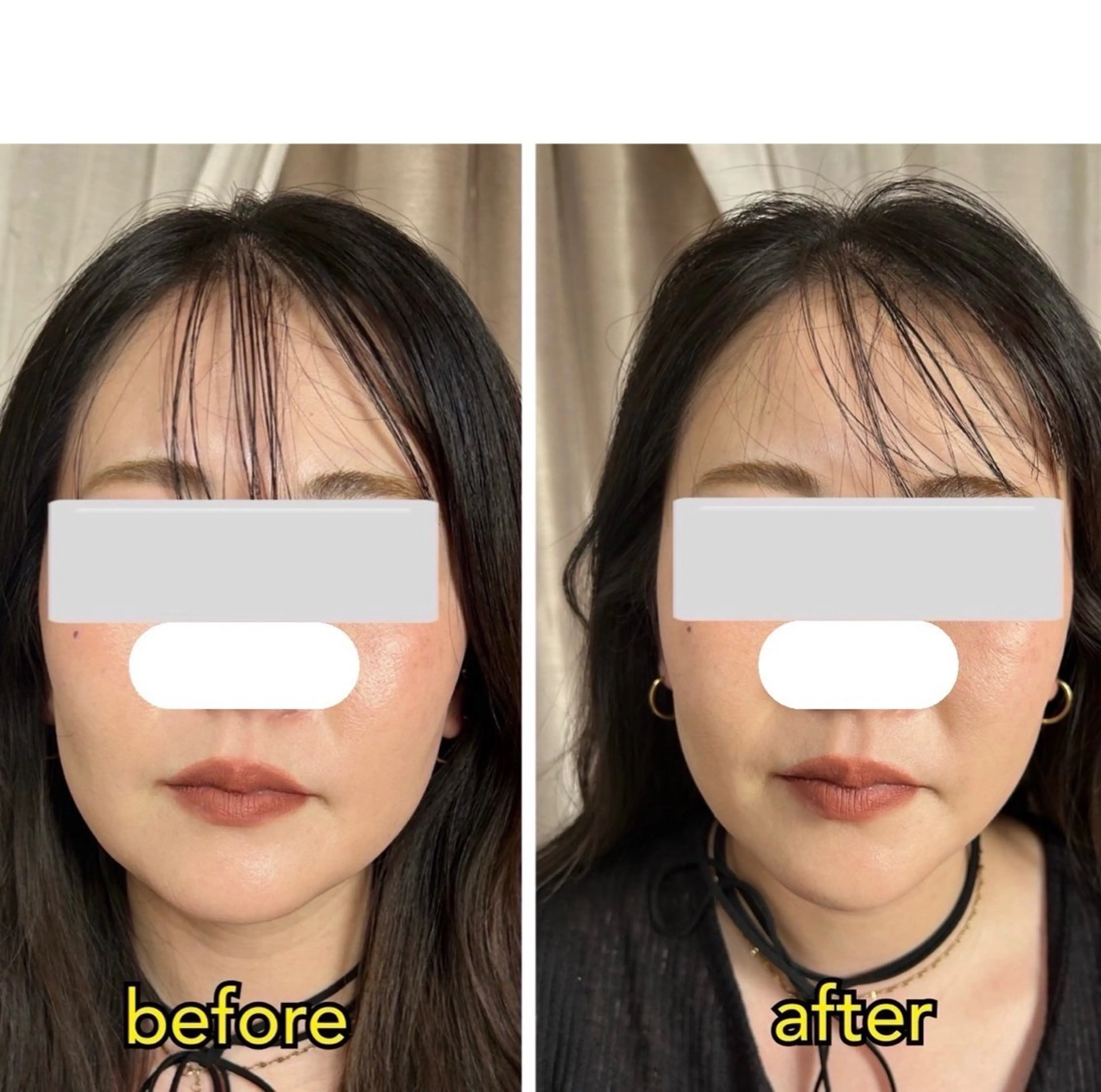 不調なところを全身調整！骨盤矯正✖️整形級小顔ヘッドスパ！肩こり頭痛も解消！の写真