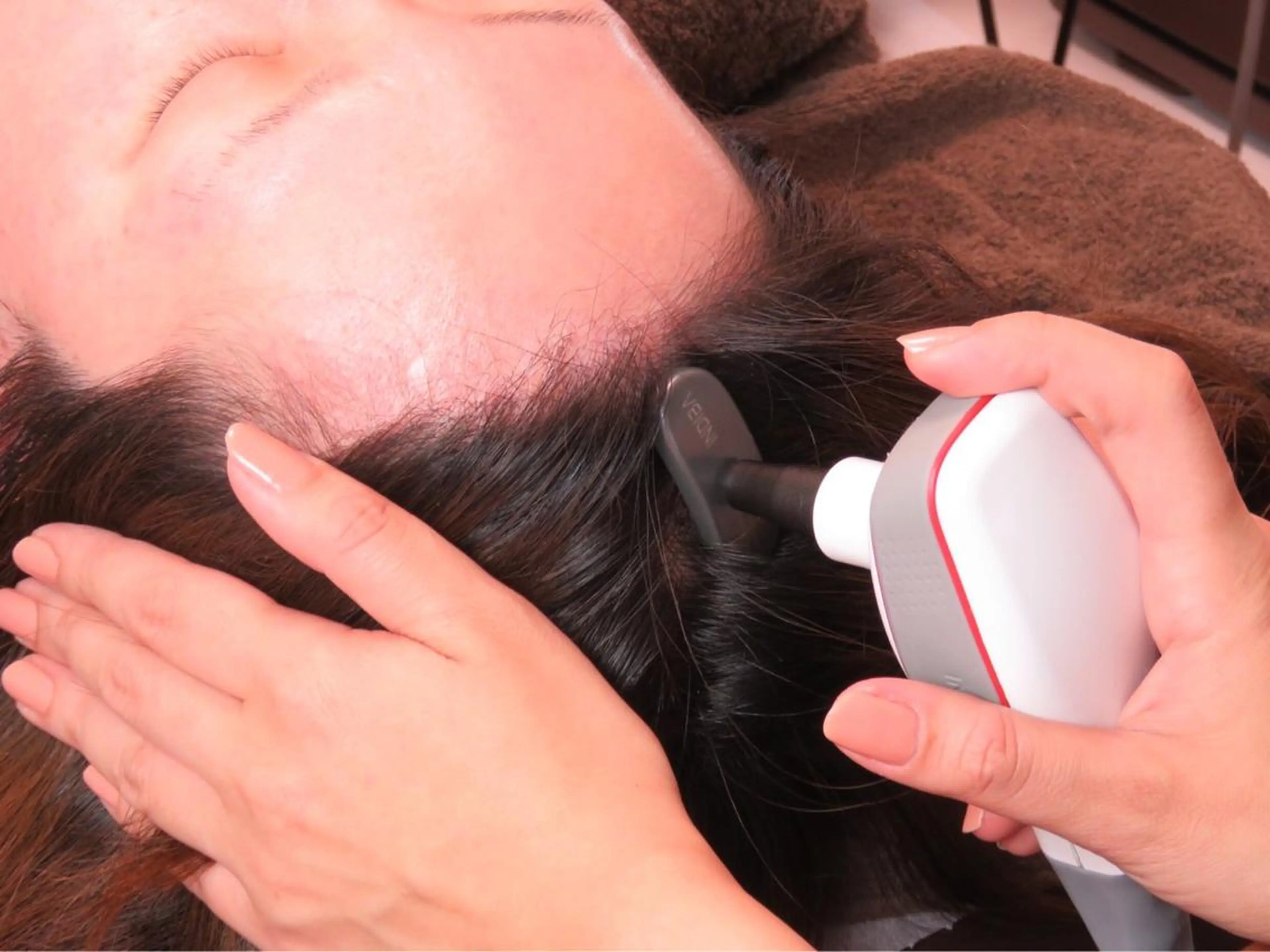 【薄毛＆引き上げ】インディバで頭皮から攻める！最強リフトアップ丸々30分◎の写真