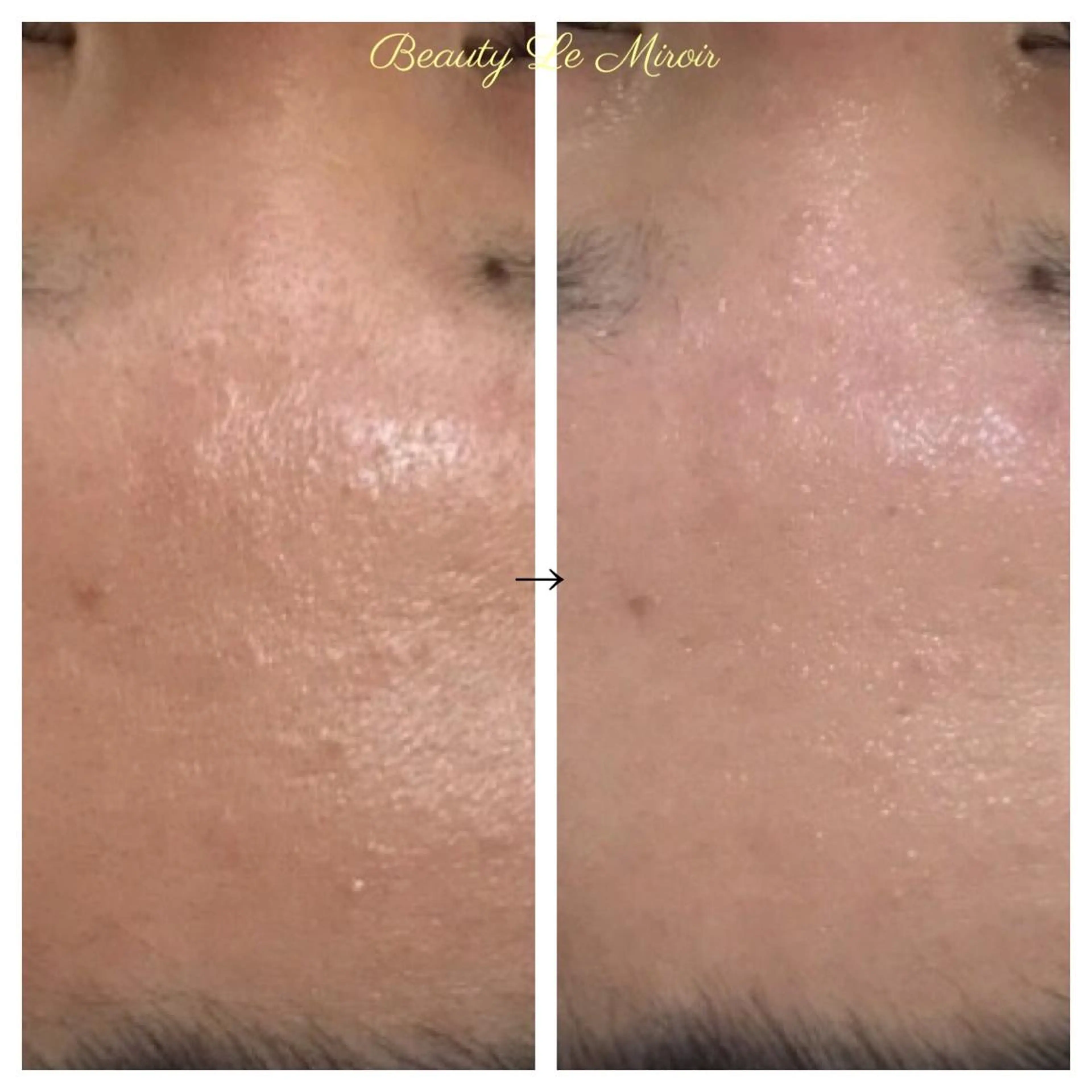 ビューティー ミロワールのエステ・リラクイメージ