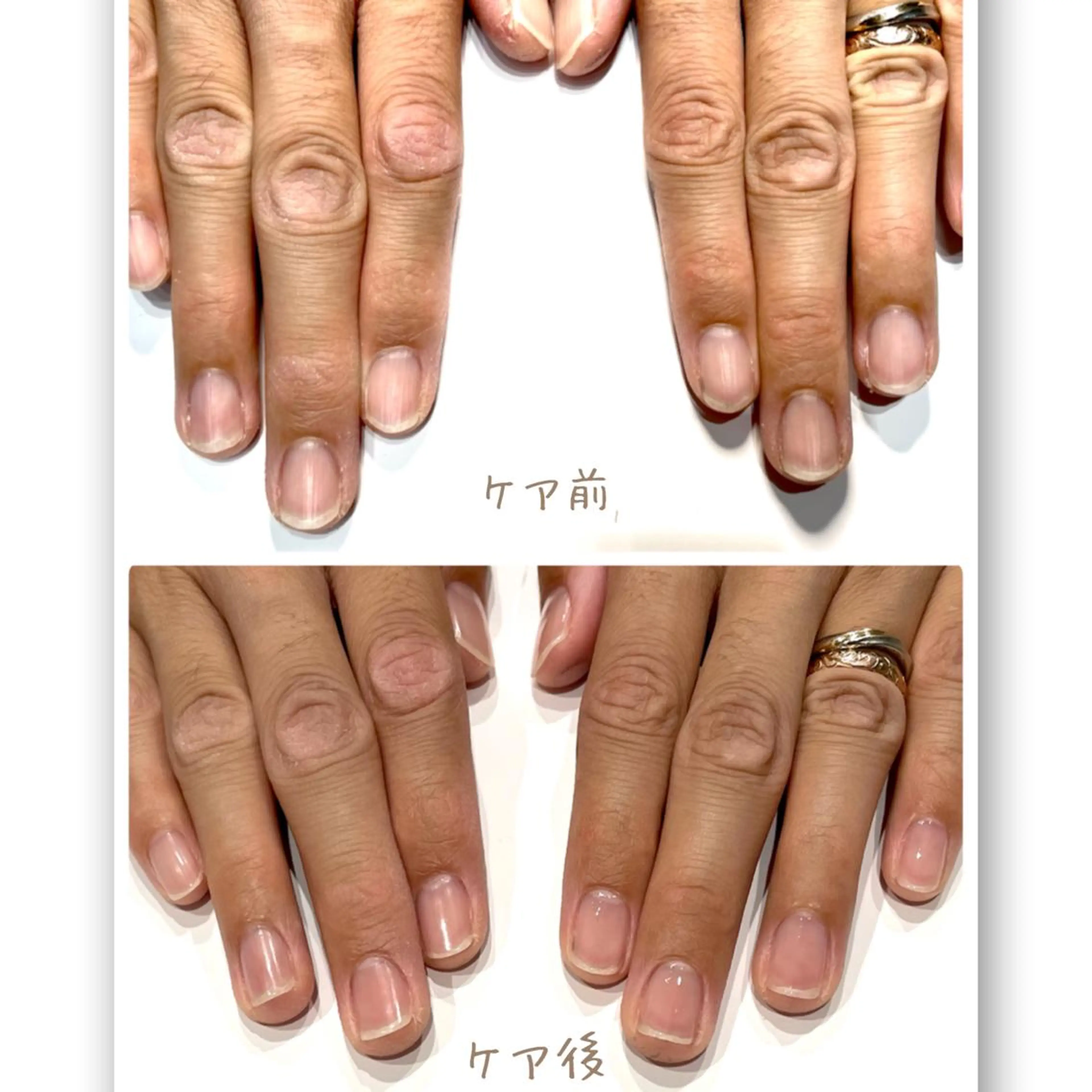 ネイル Aim* 深爪・自爪育成専門店のネイルデザイン