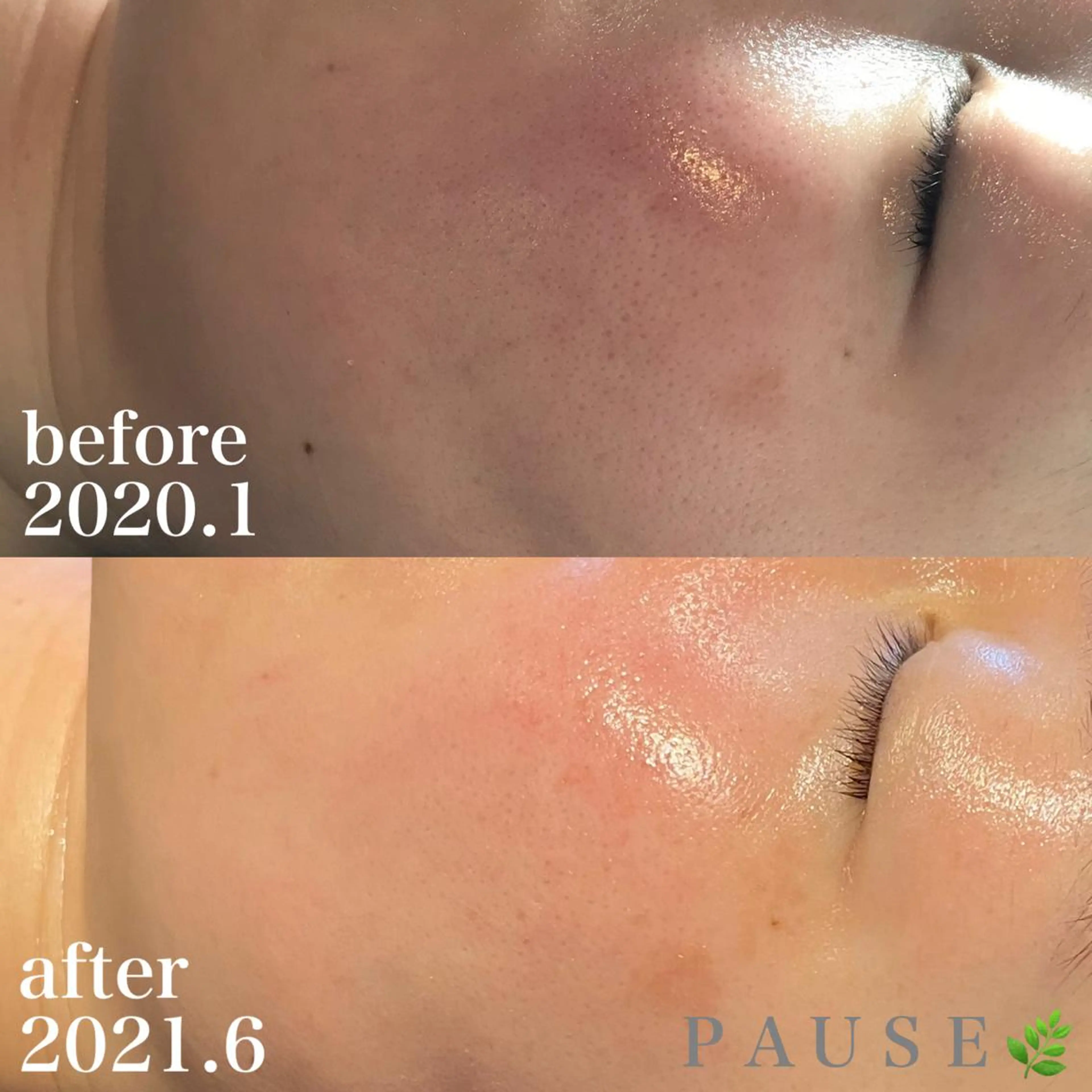 エステ 浜野 恵美のエステ・リラクイメージ