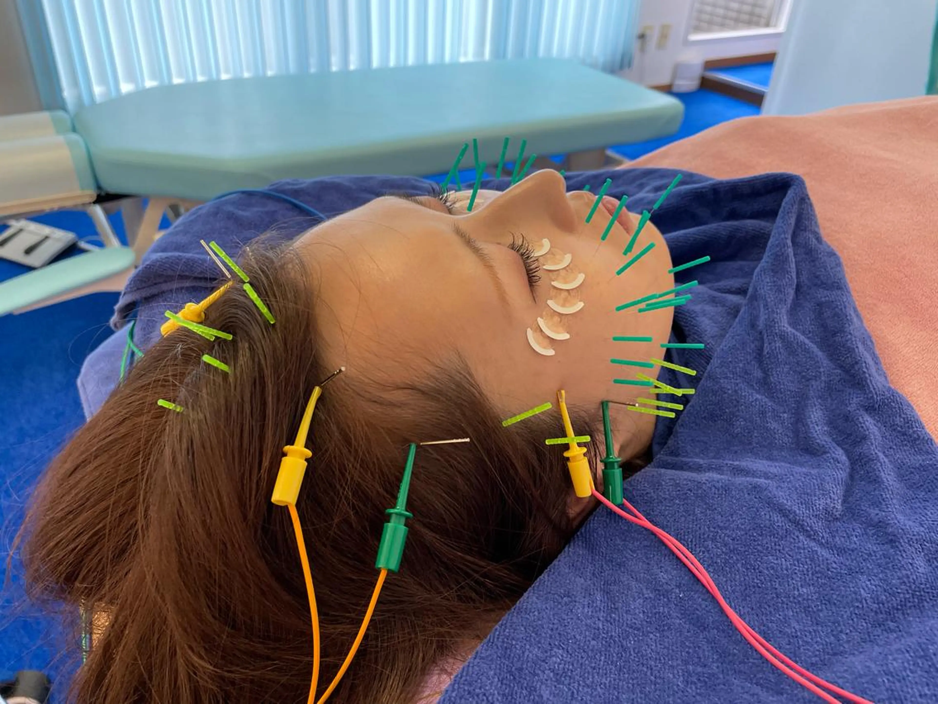 小顔美容鍼専門サロン 渋谷YZのその他イメージ