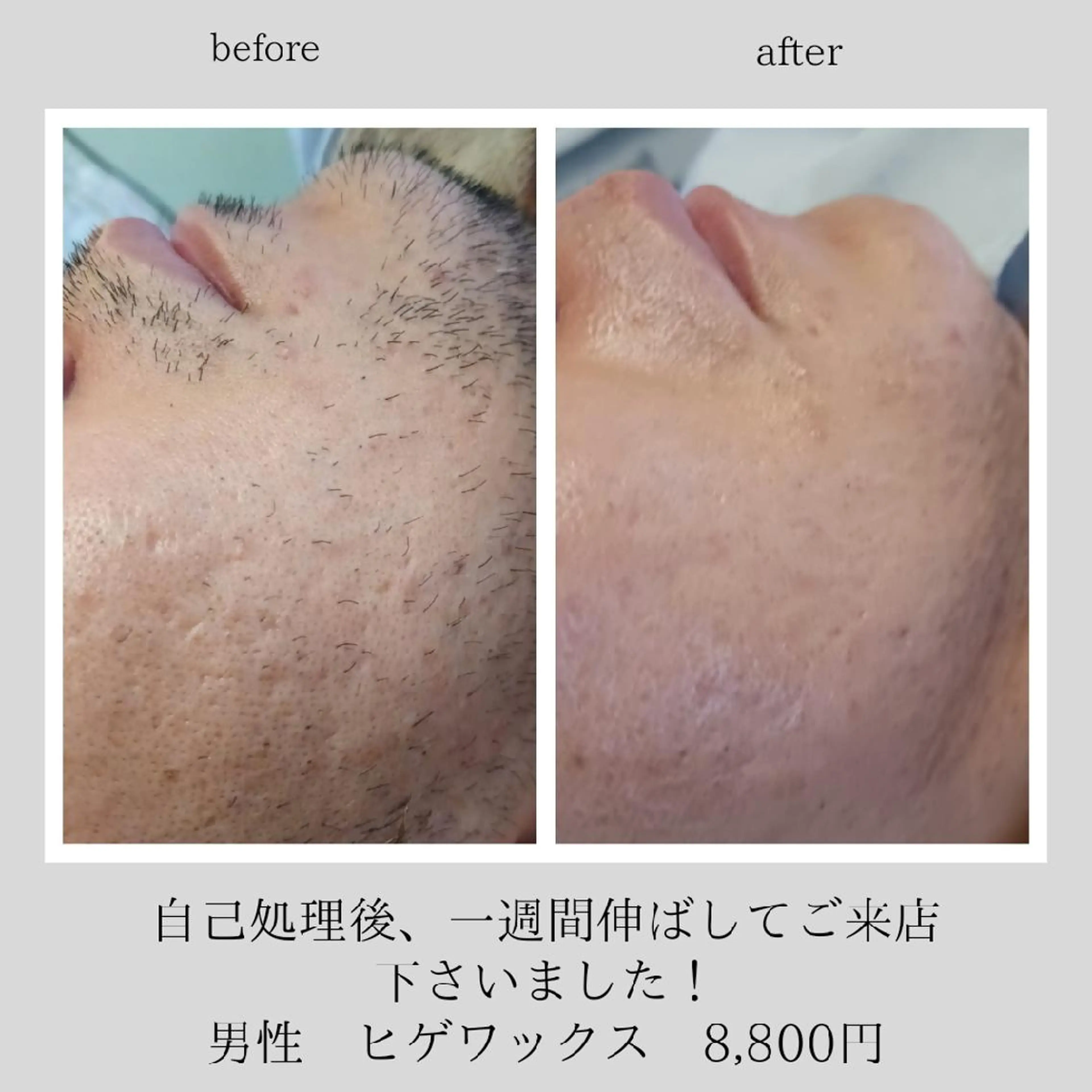 メンズ Lutella所属・ワックス脱毛専門店 Lutellaのエステ・リラクイメージ