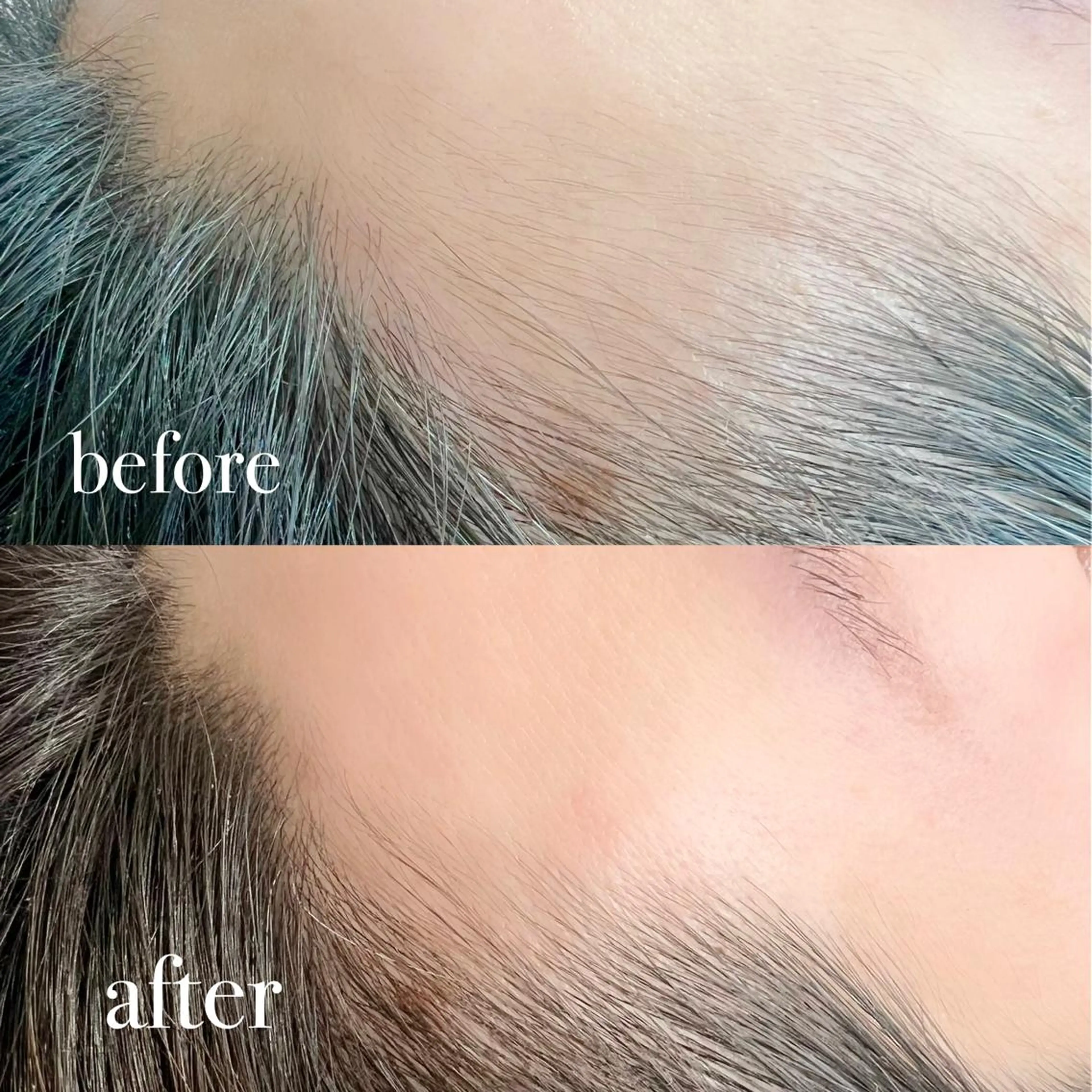 &me beautyのネイルデザイン