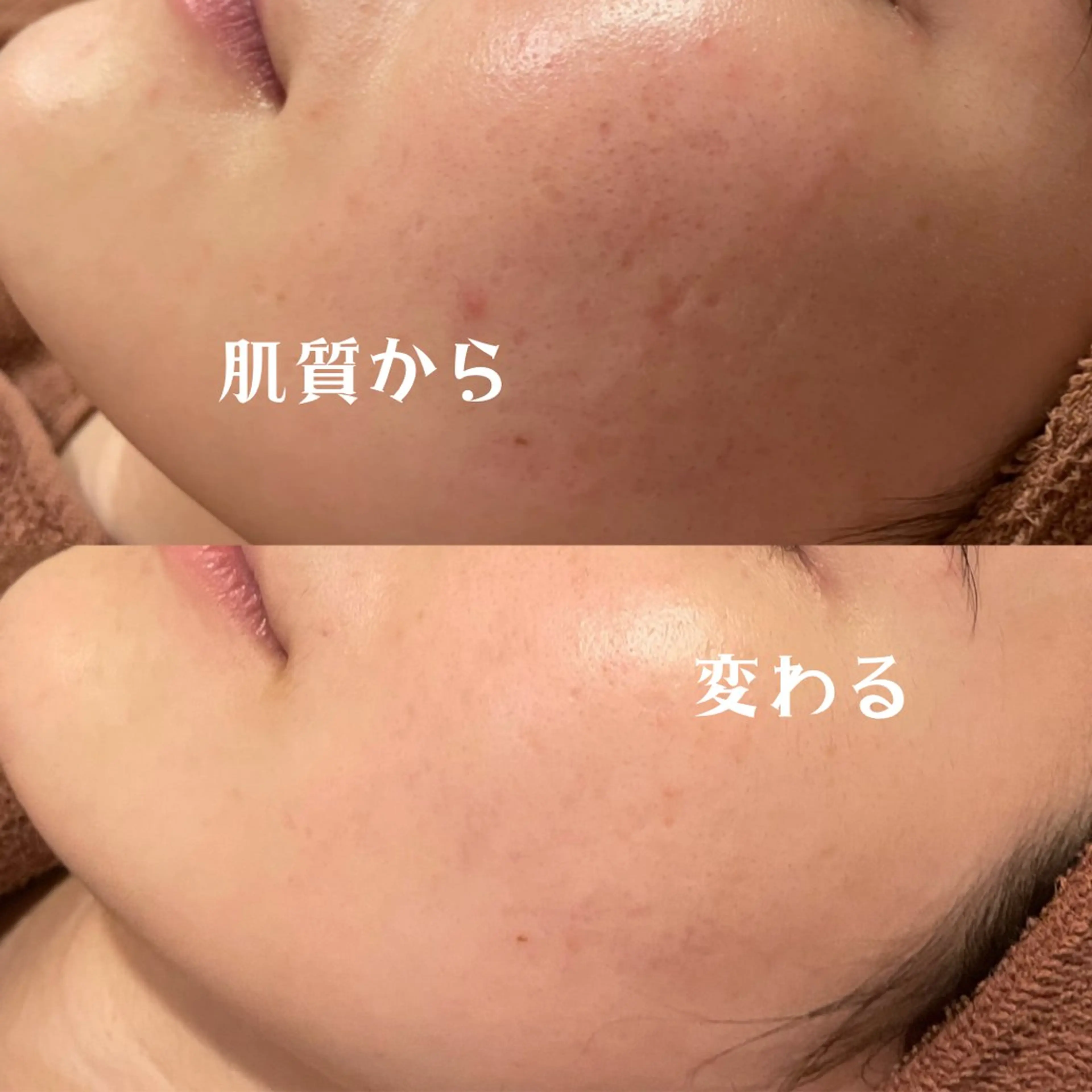 エステ リラク 触れたくなる モテ肌へ...❤︎のエステ・リラクイメージ