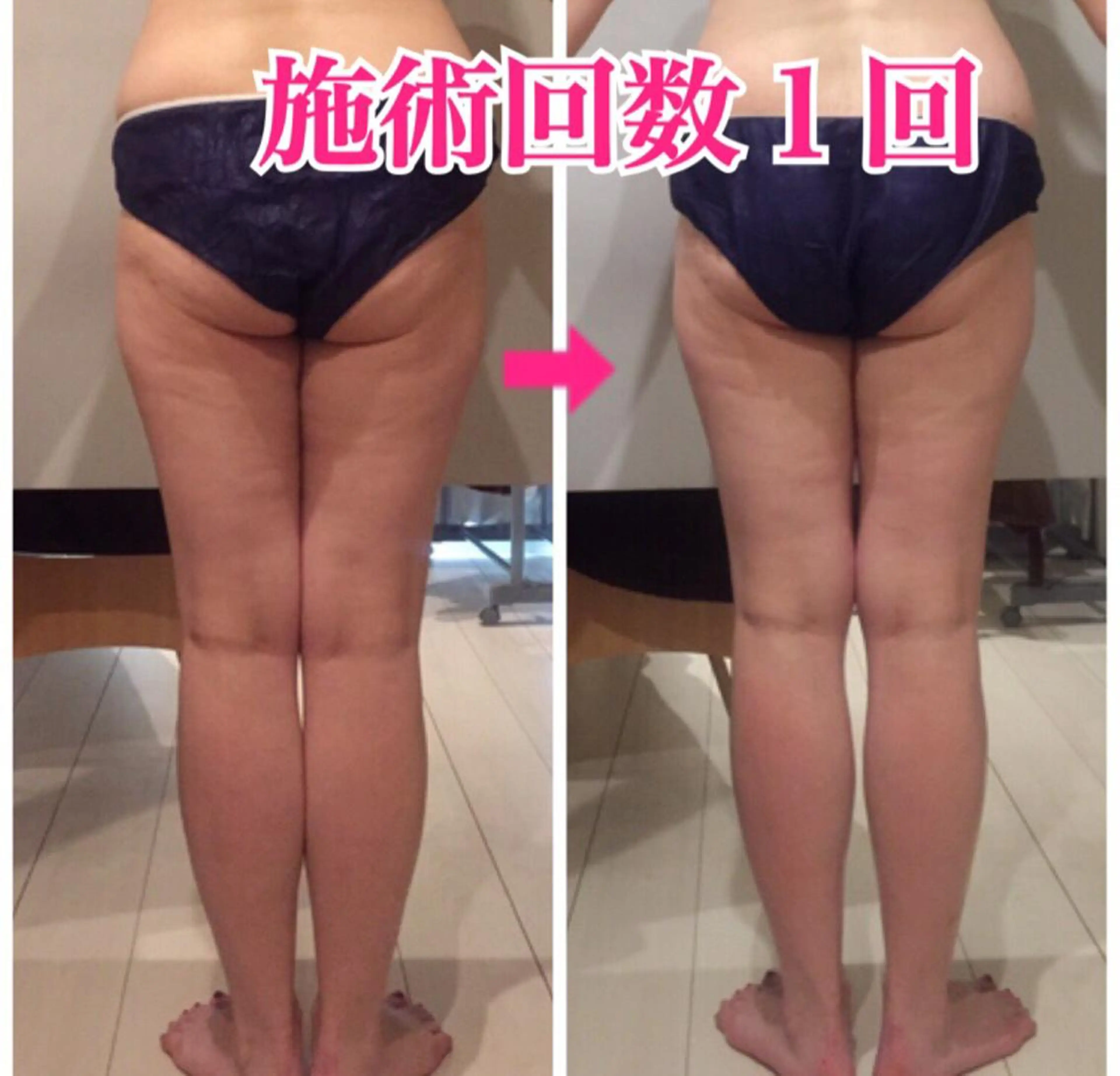 ロング カラー ヘアアレンジ メンズ キッズ ネイル マツエク・マツパ ‍痩身＆ボディ 結果出し🌟丹野のエステ・リラクイメージ