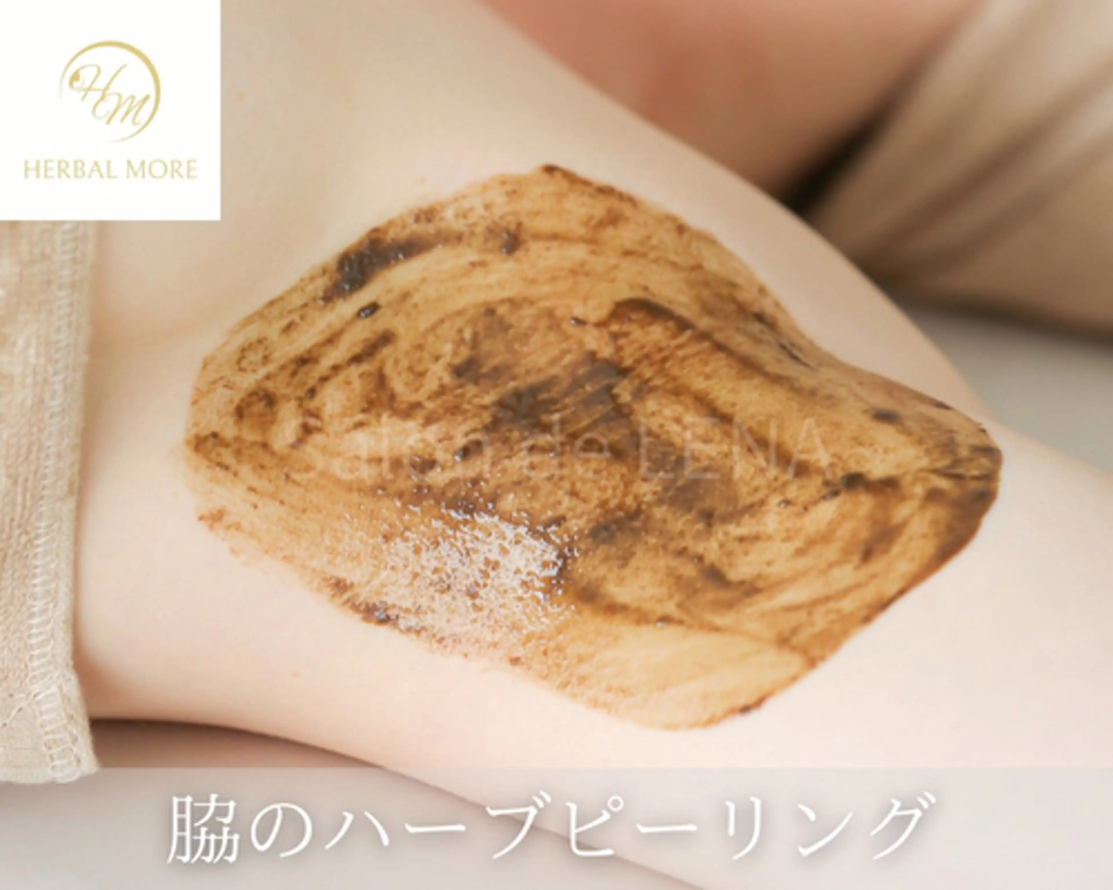 【脇ハーブピーリング／剥離有・無】の写真