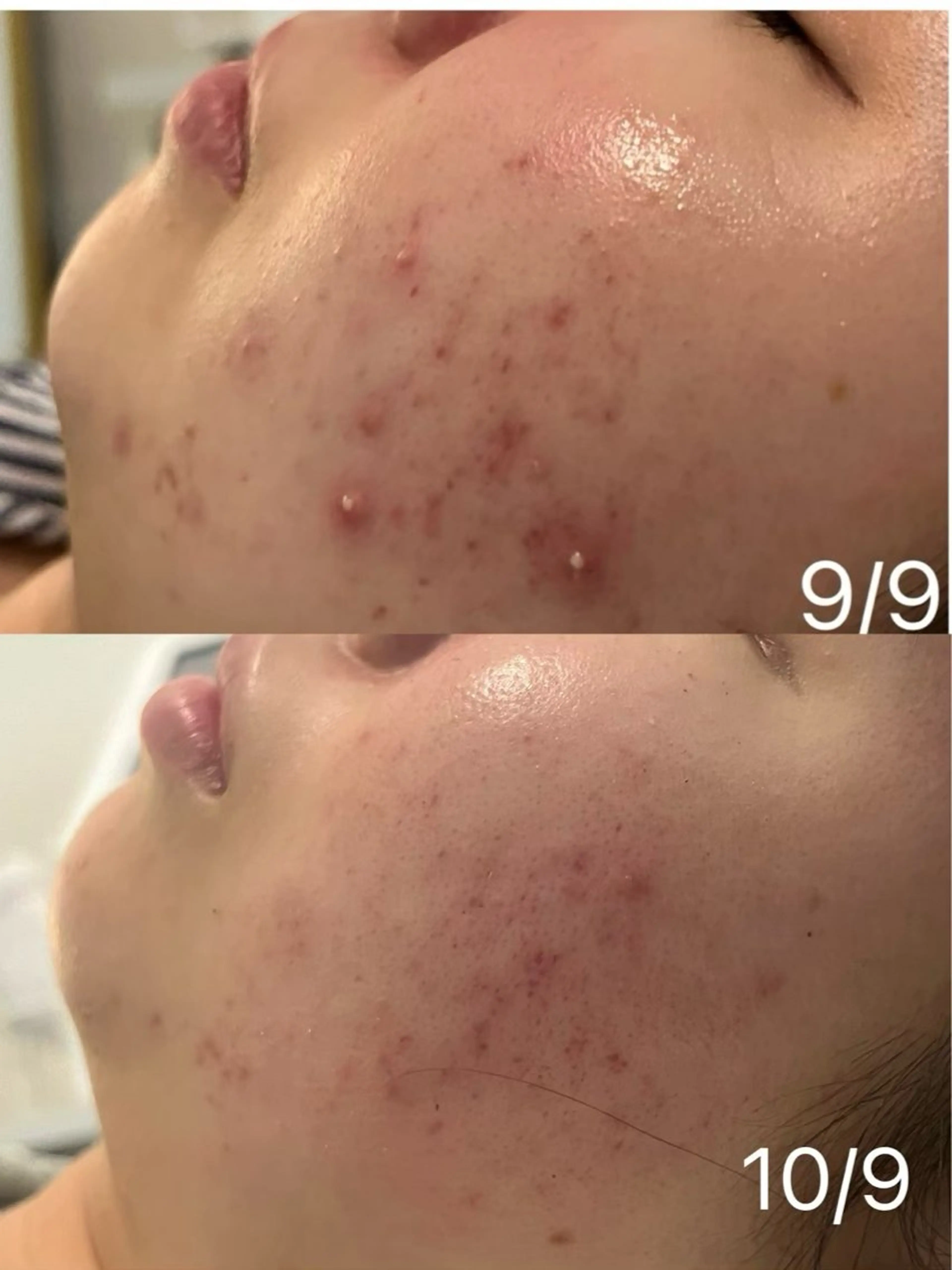 Belle所属・韓国肌管理 Belleのエステ・リラクイメージ