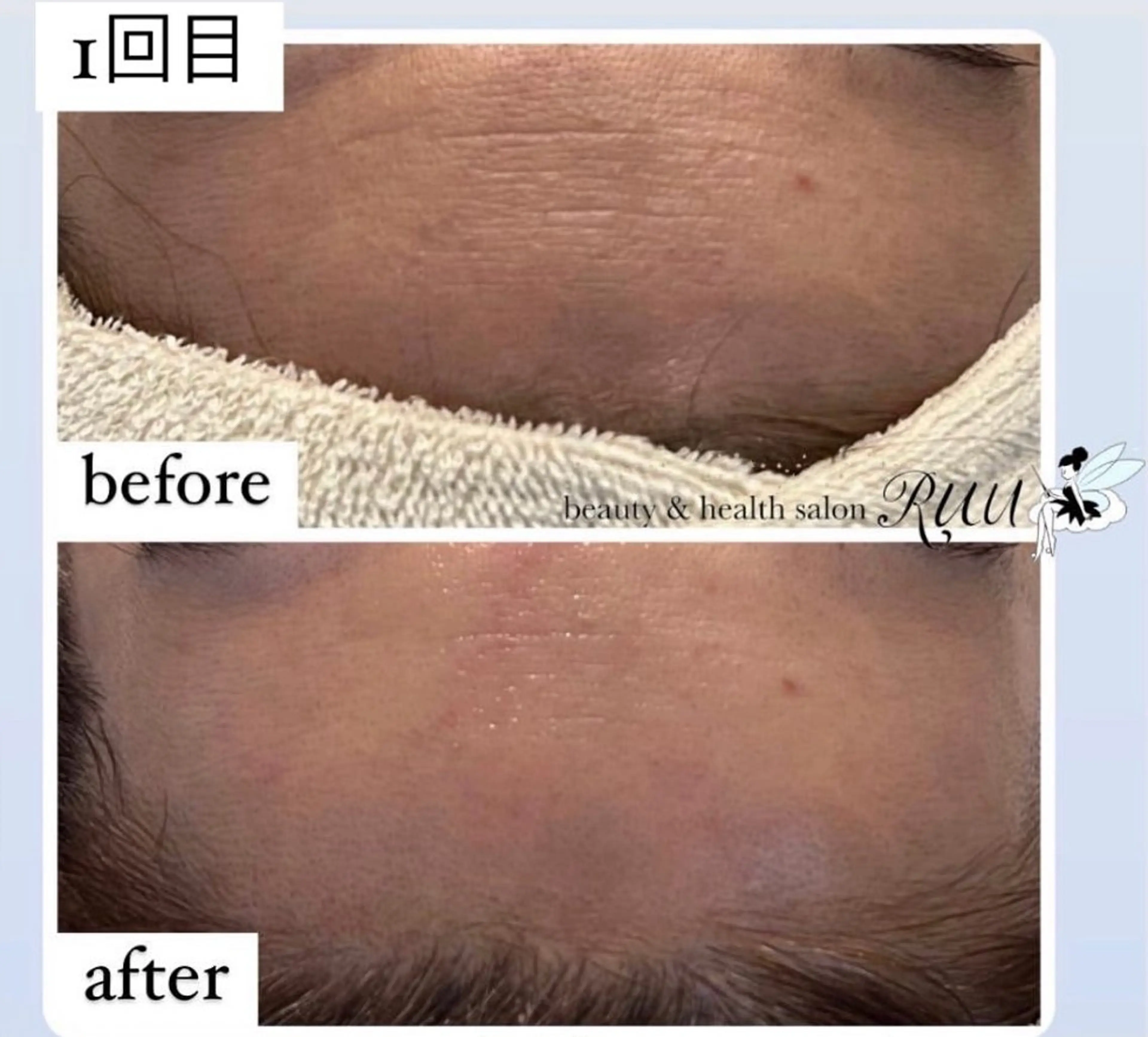 【頭痛、睡眠改善】 salon RUUのエステ・リラクイメージ