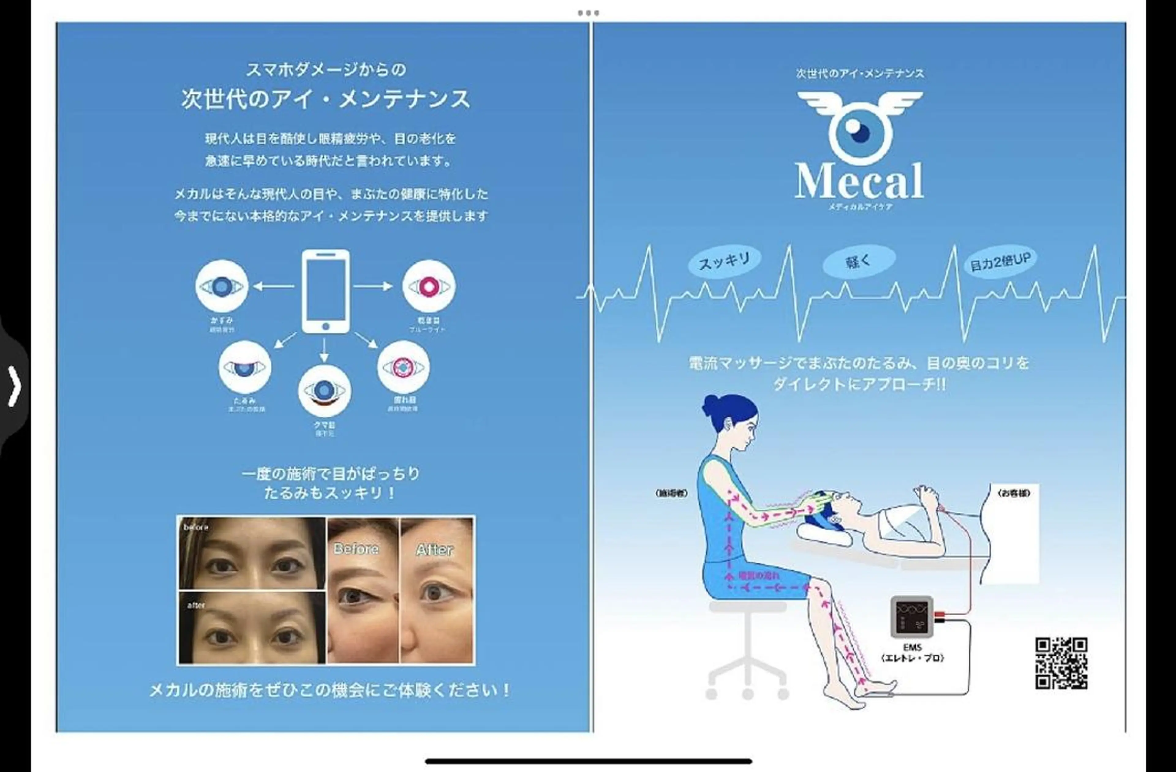 Mecal RYOKOのその他イメージ
