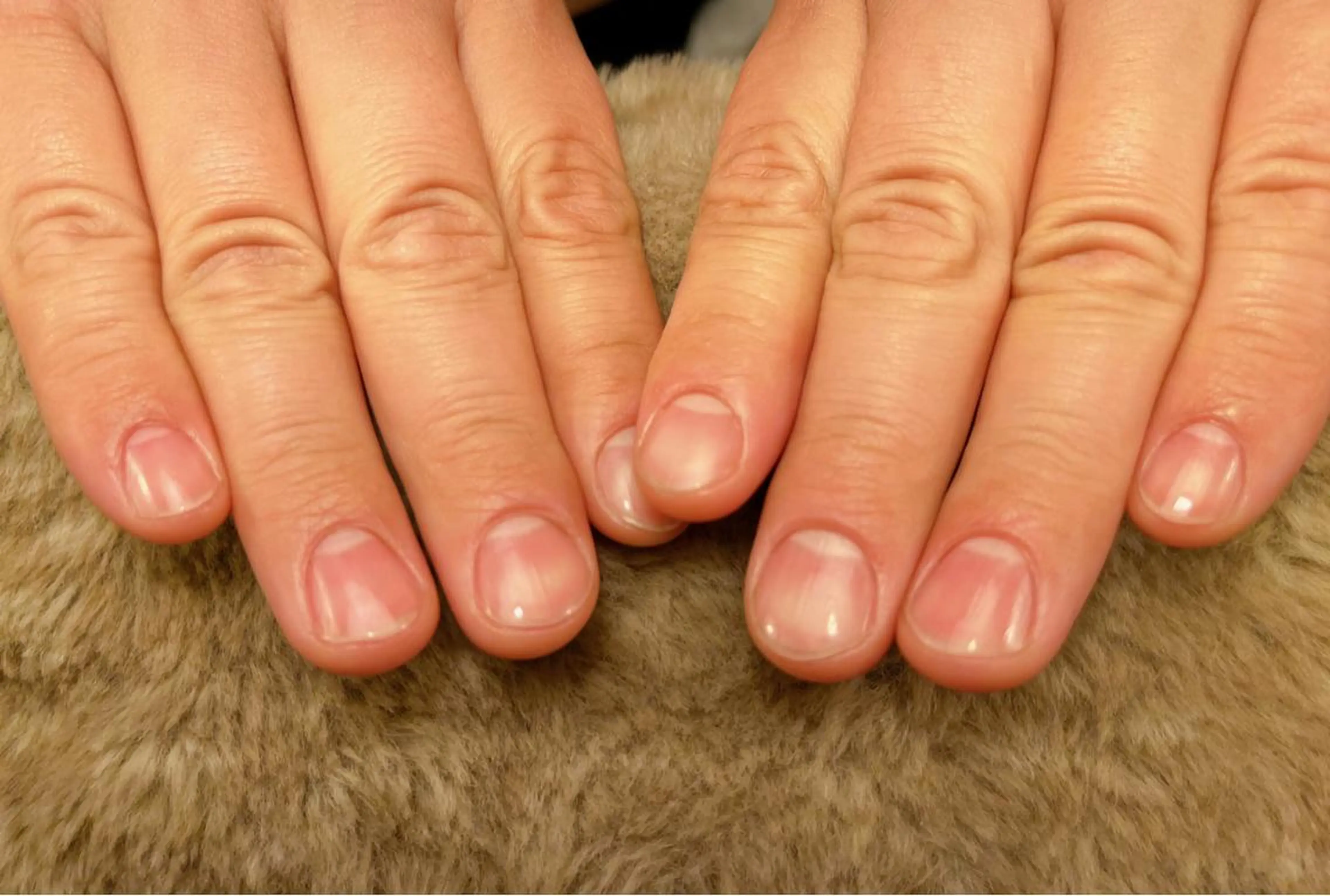 ケアのみの写真