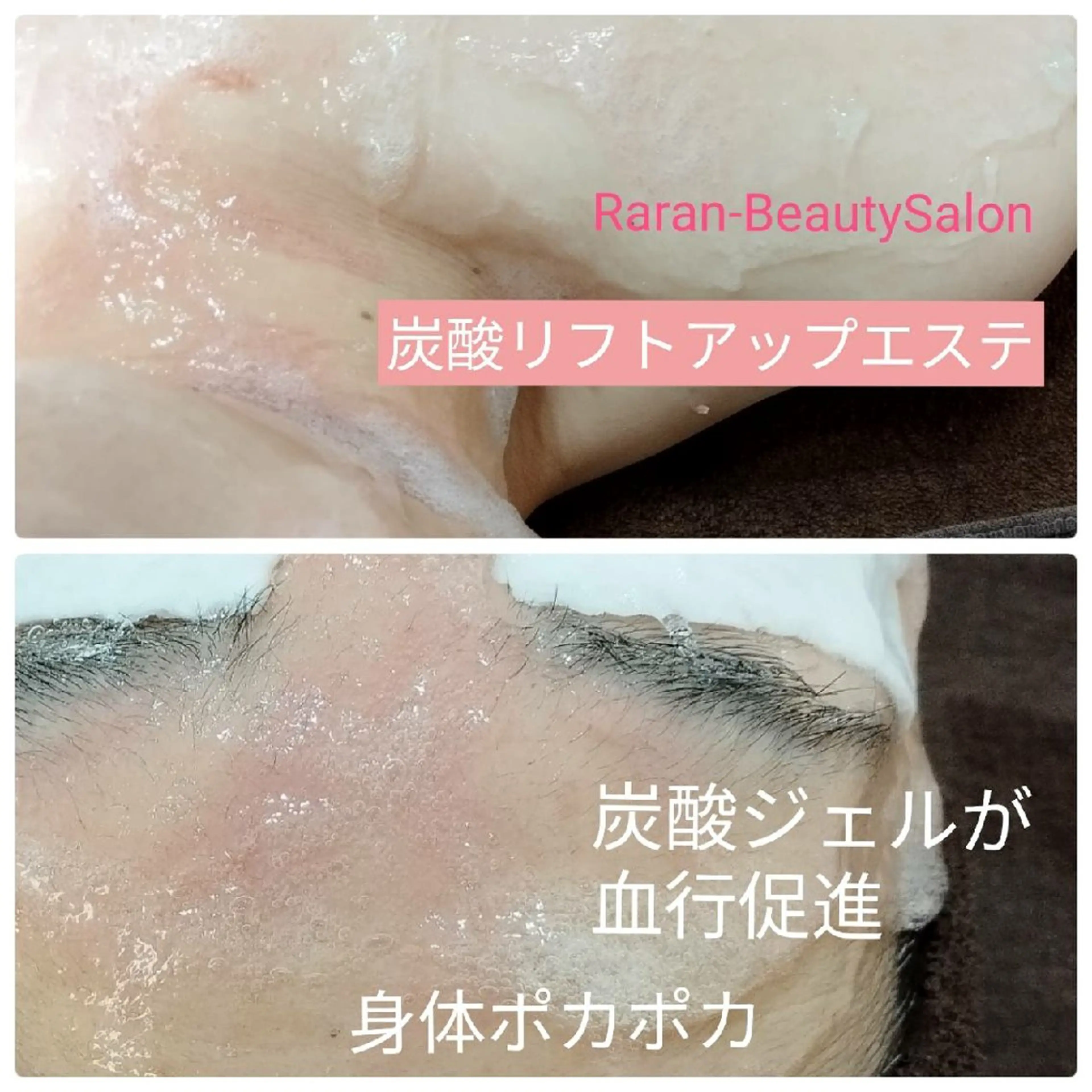 【ミネラル炭酸美容* リフトアップコース】 美白✨リフトアップ✨コリ✨シミ✨の写真