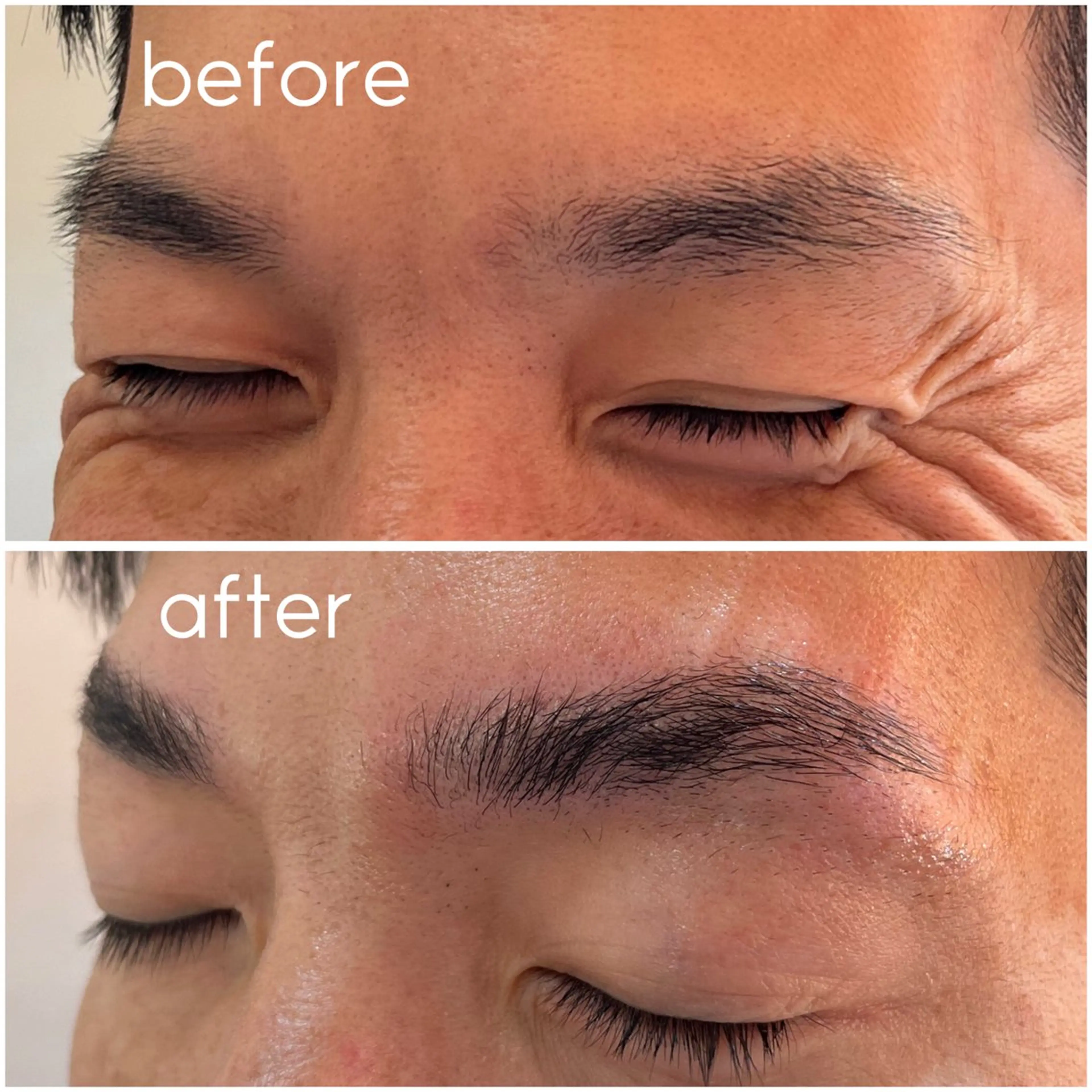 【先着20名様】眉毛パーマ+シートワックス脱毛【男女🆗】の写真