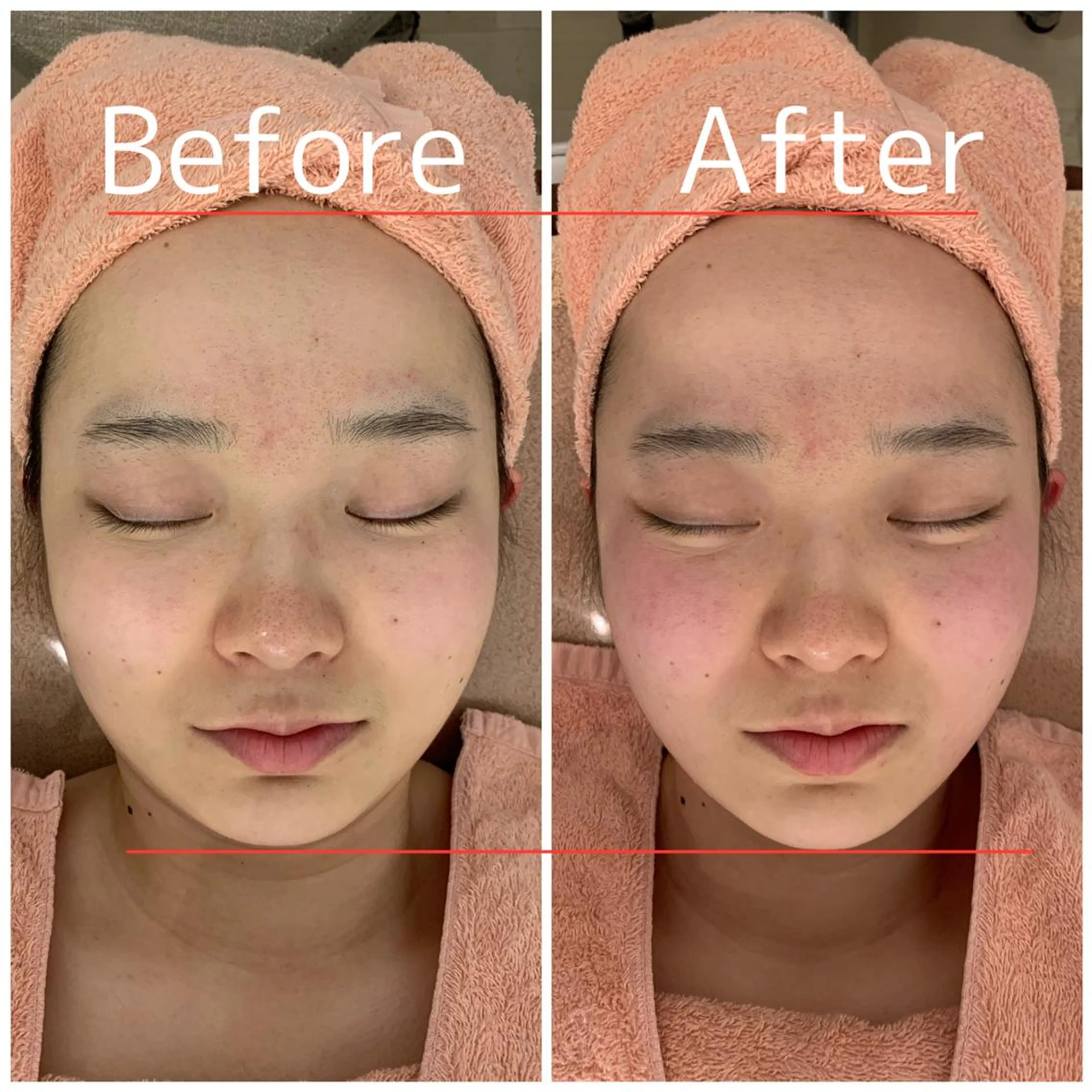 OPREA 千種店のエステ・リラクイメージ