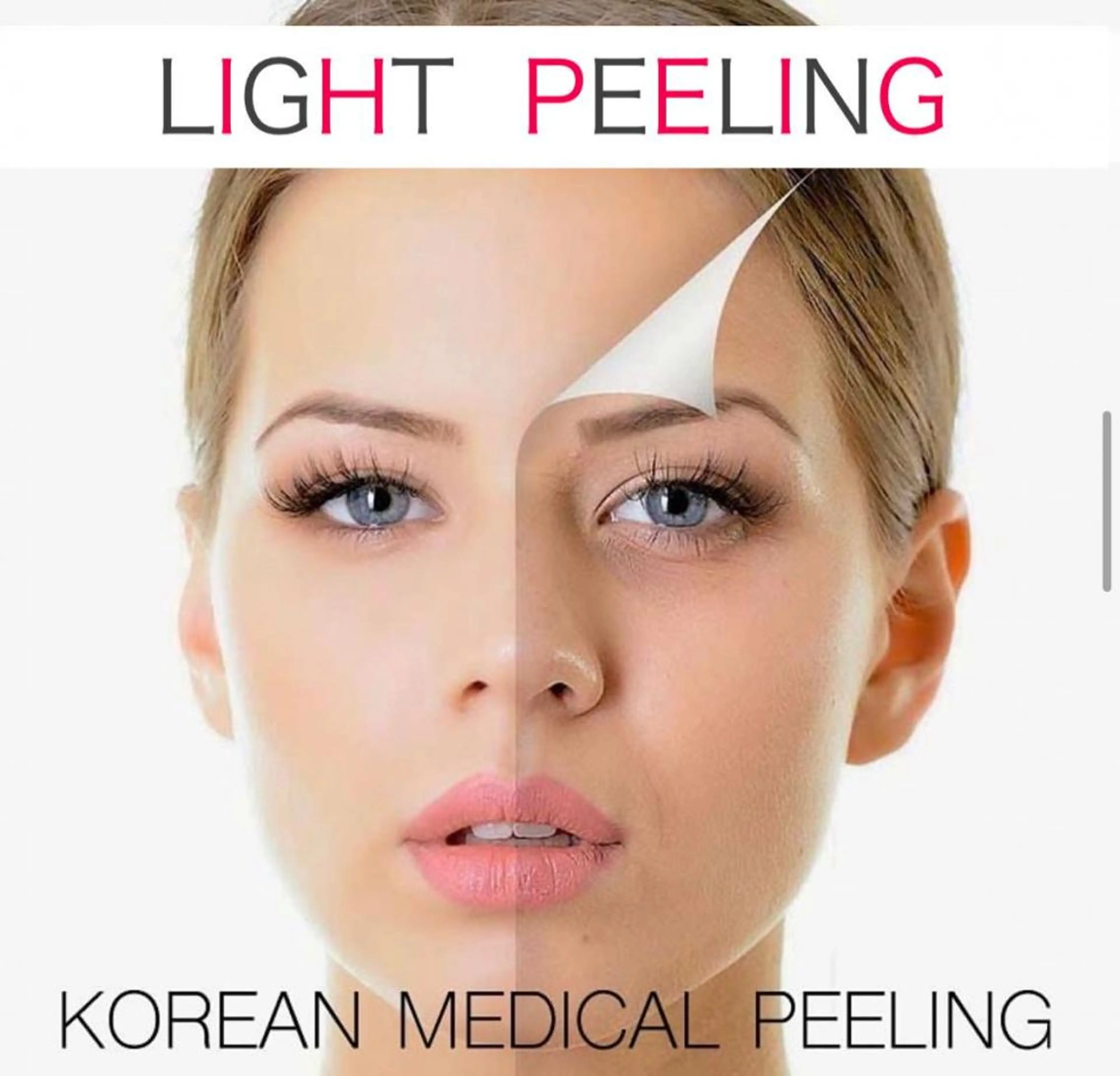 水光肌ピーリング　練習モデルの写真