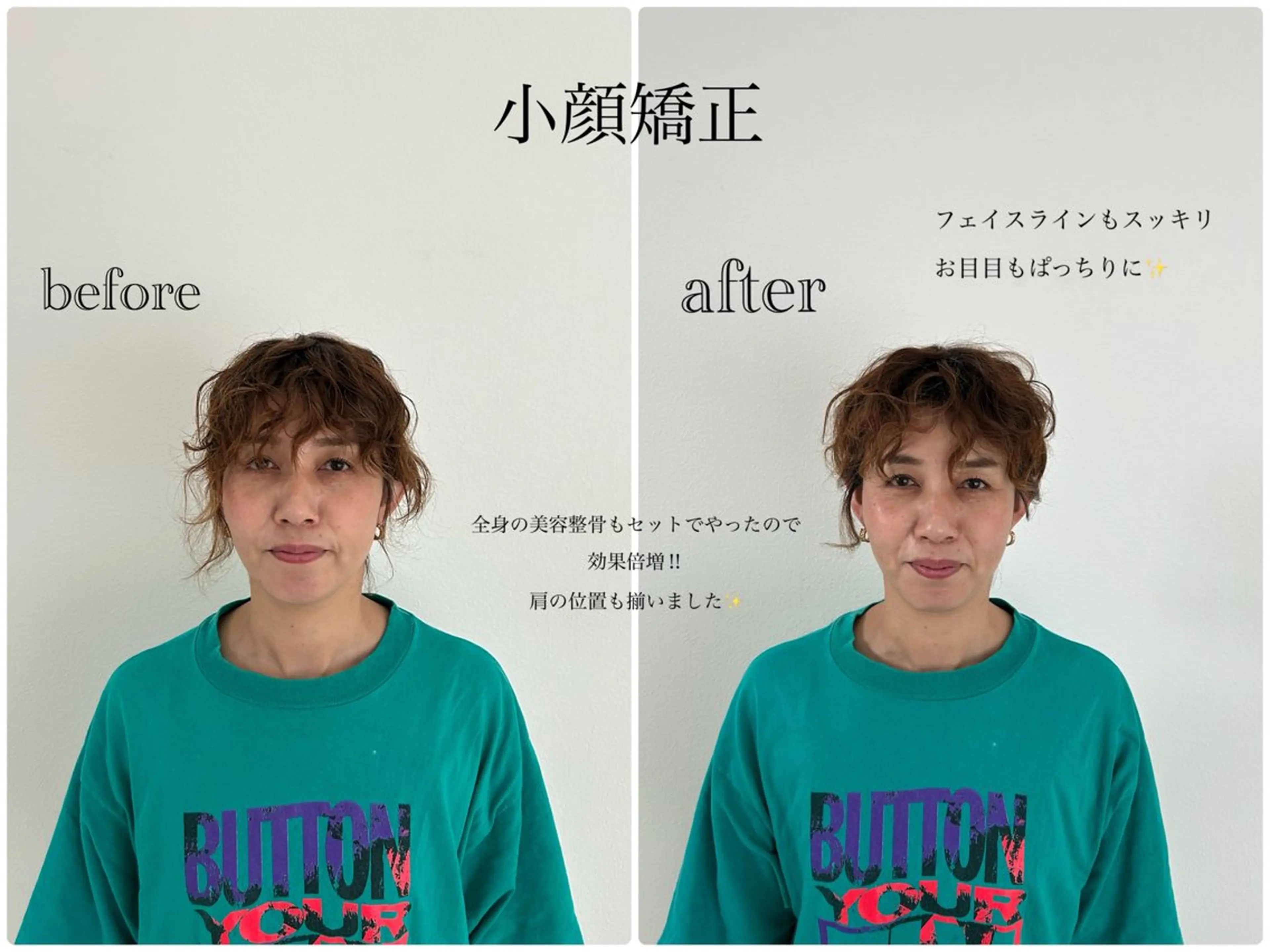 エステ 美容サロン ito所属・美容サロン itoのマツエク・マツパデザイン