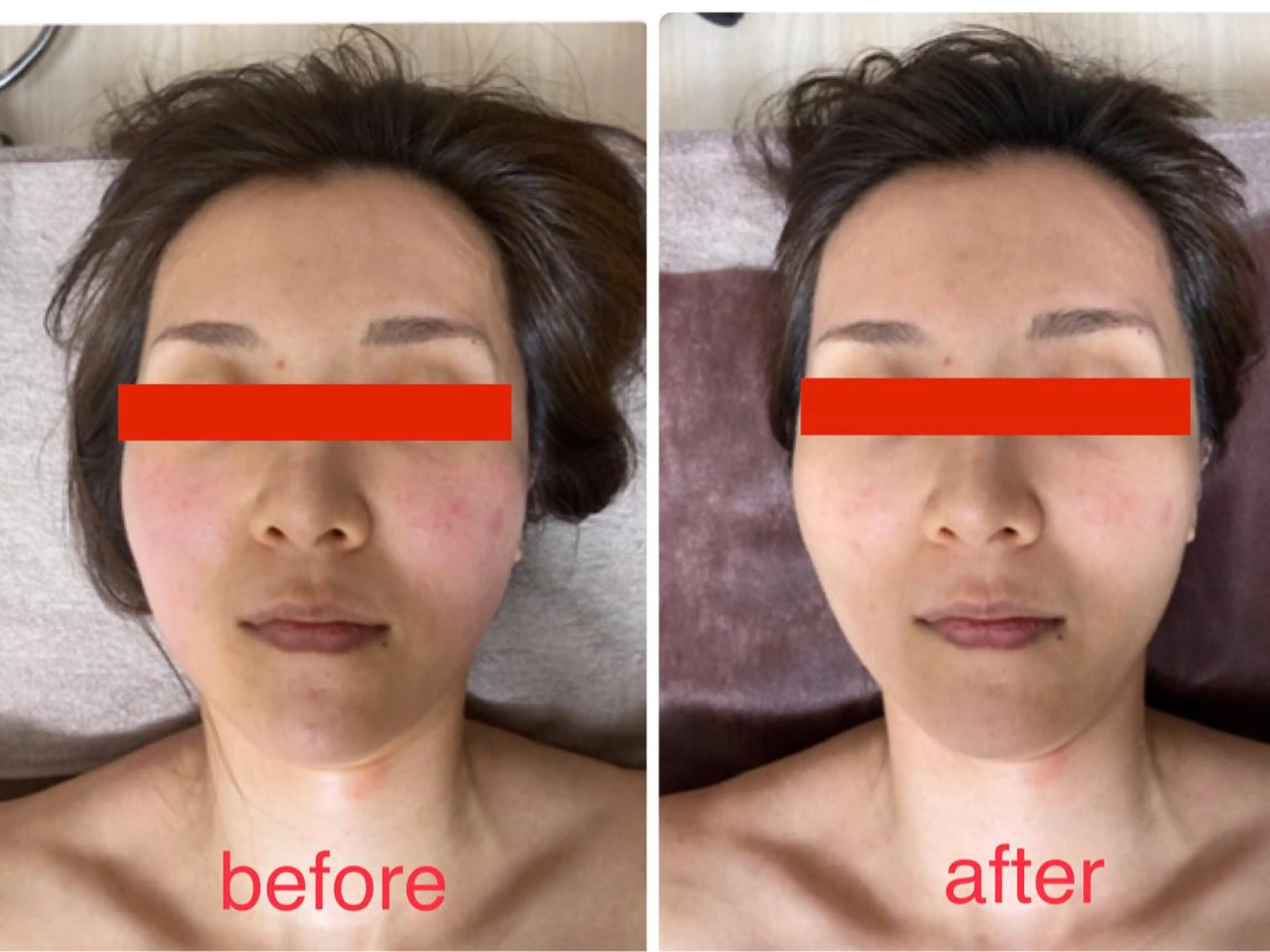 エステ 美ola ビオラのエステ・リラクイメージ