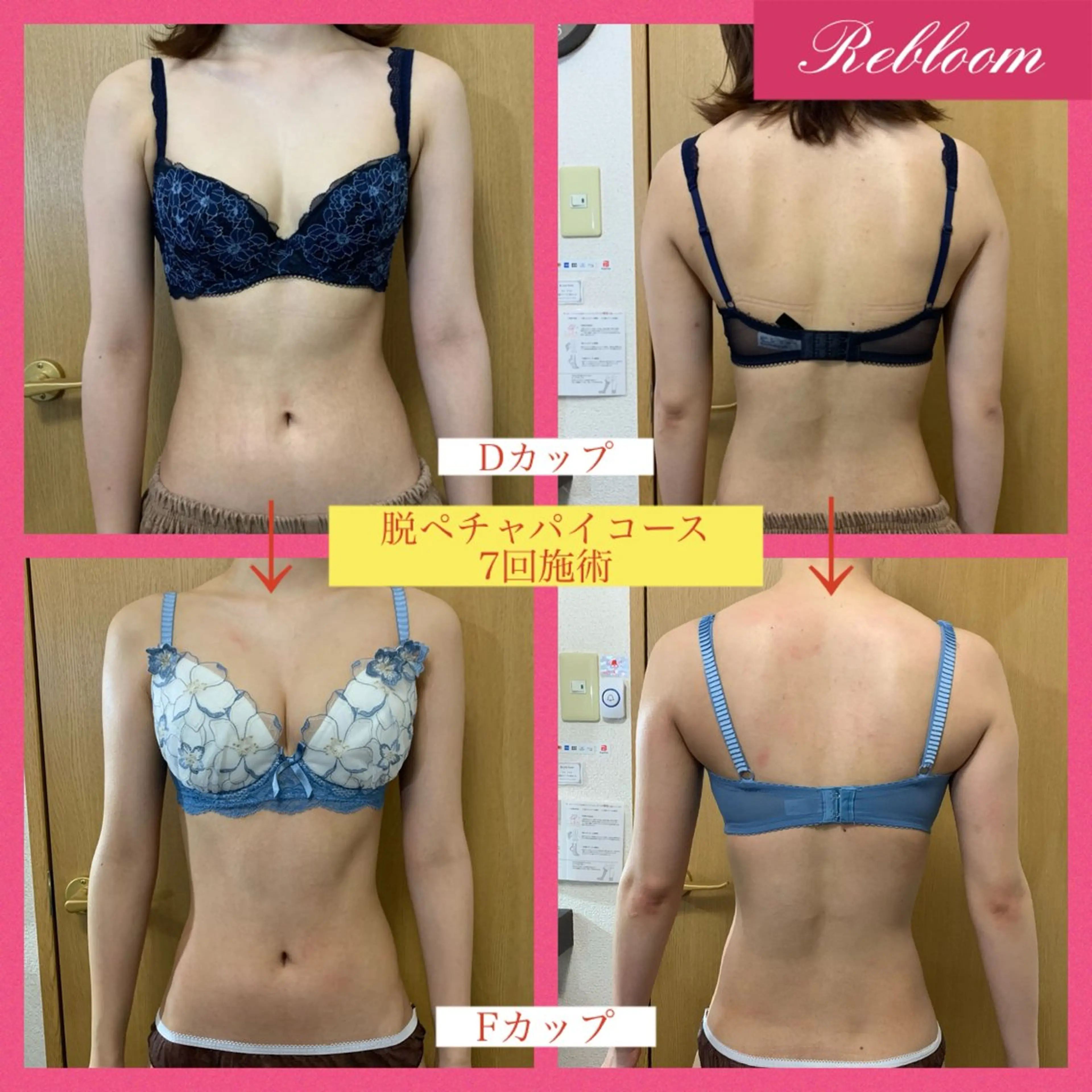 Sakurako式！脱ペチャパイコース（バストアップ）の写真