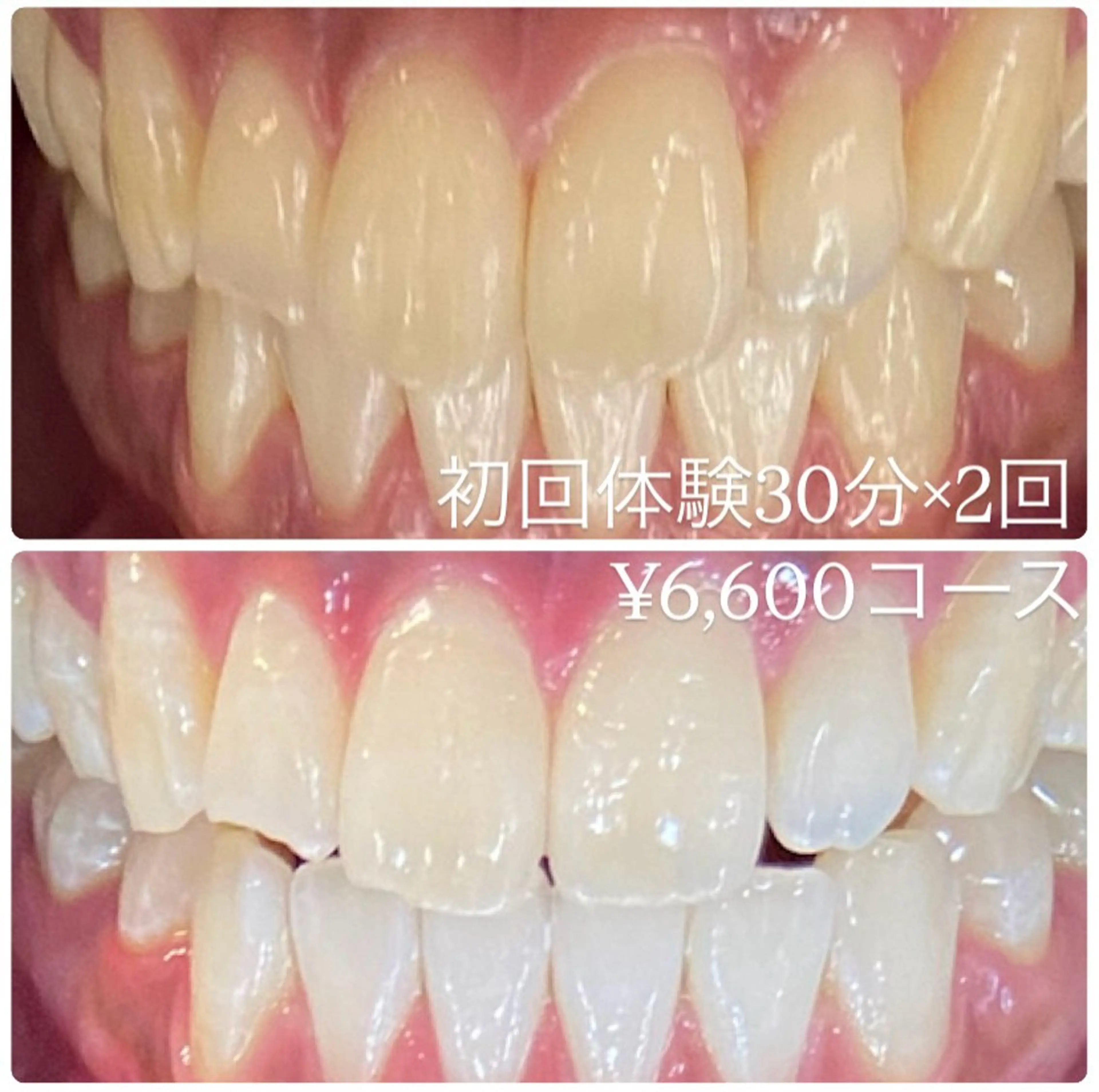 PLATINUM Beauty 横浜店所属・ホワイトニングルーム 横浜店のその他イメージ