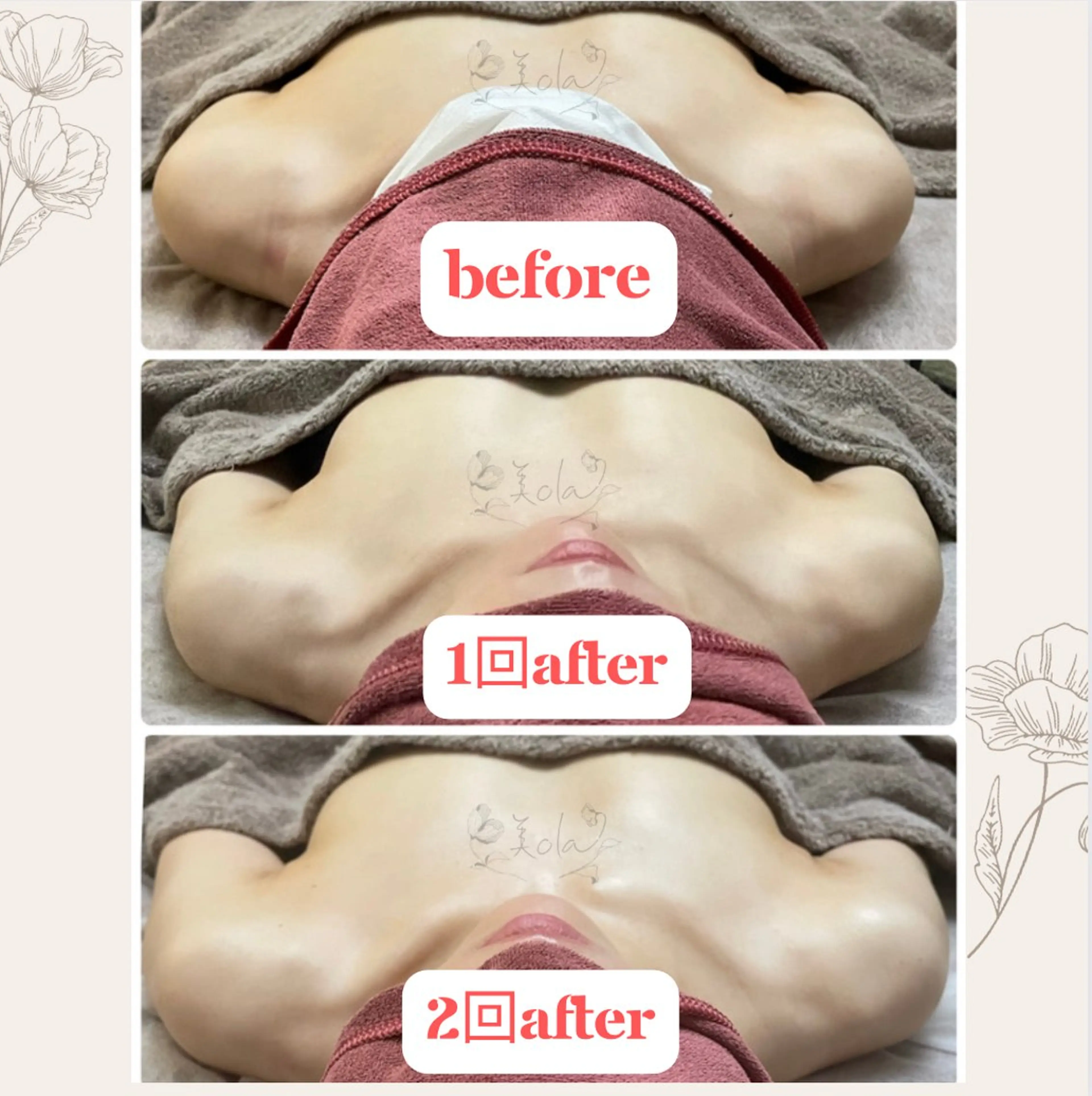 その他 美ola ビオラのエステ・リラクイメージ