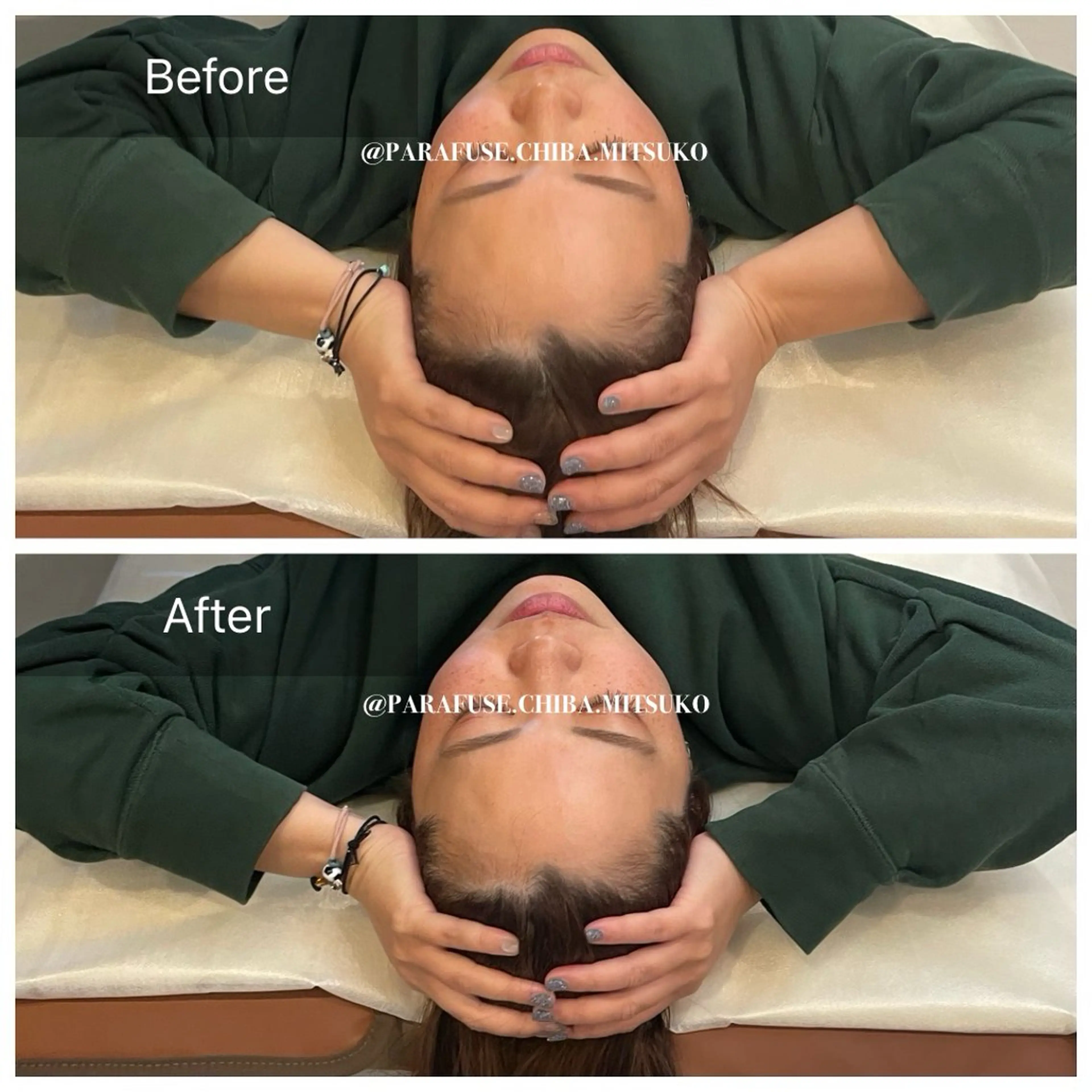 【脳洗浄®70分ドライコース】短時間でリフレッシュしたい方！の写真