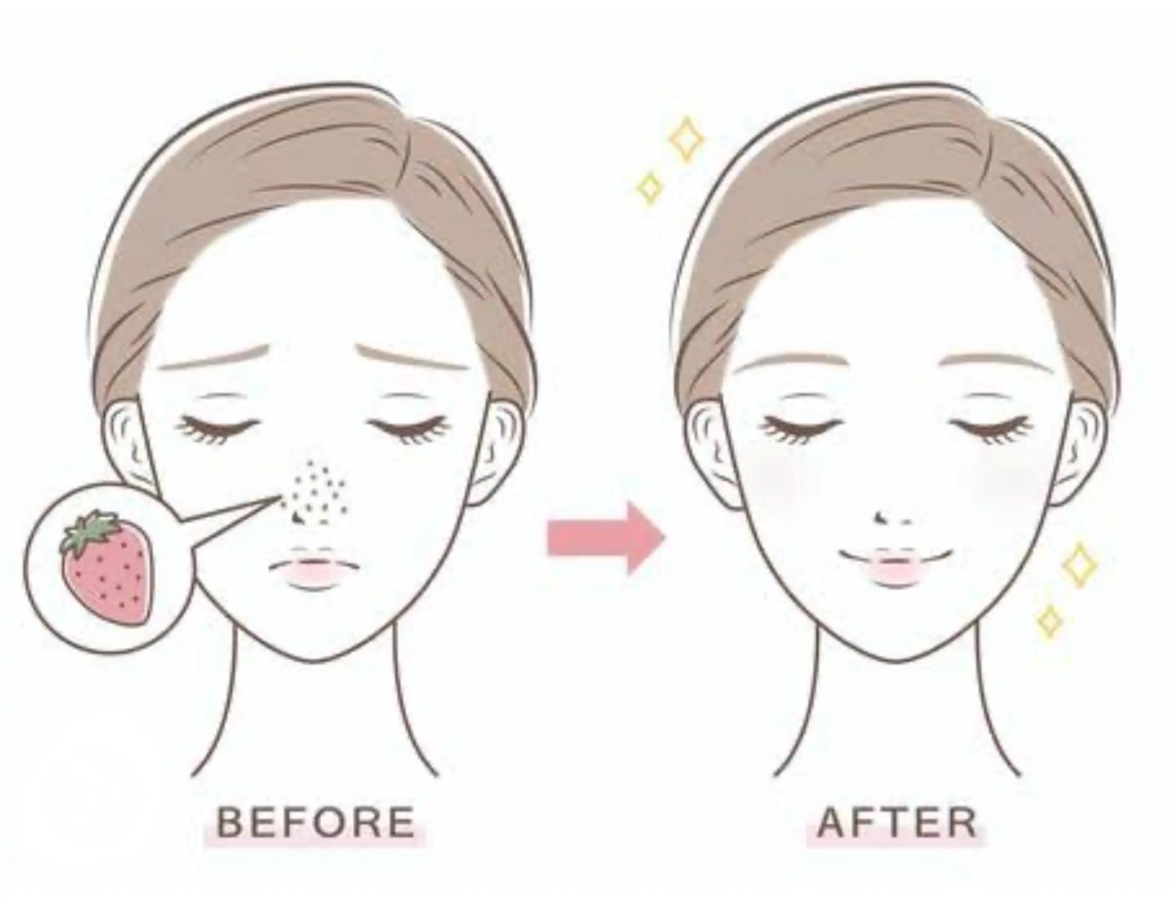 まつげ、毛穴 TREEのエステ・リラクイメージ