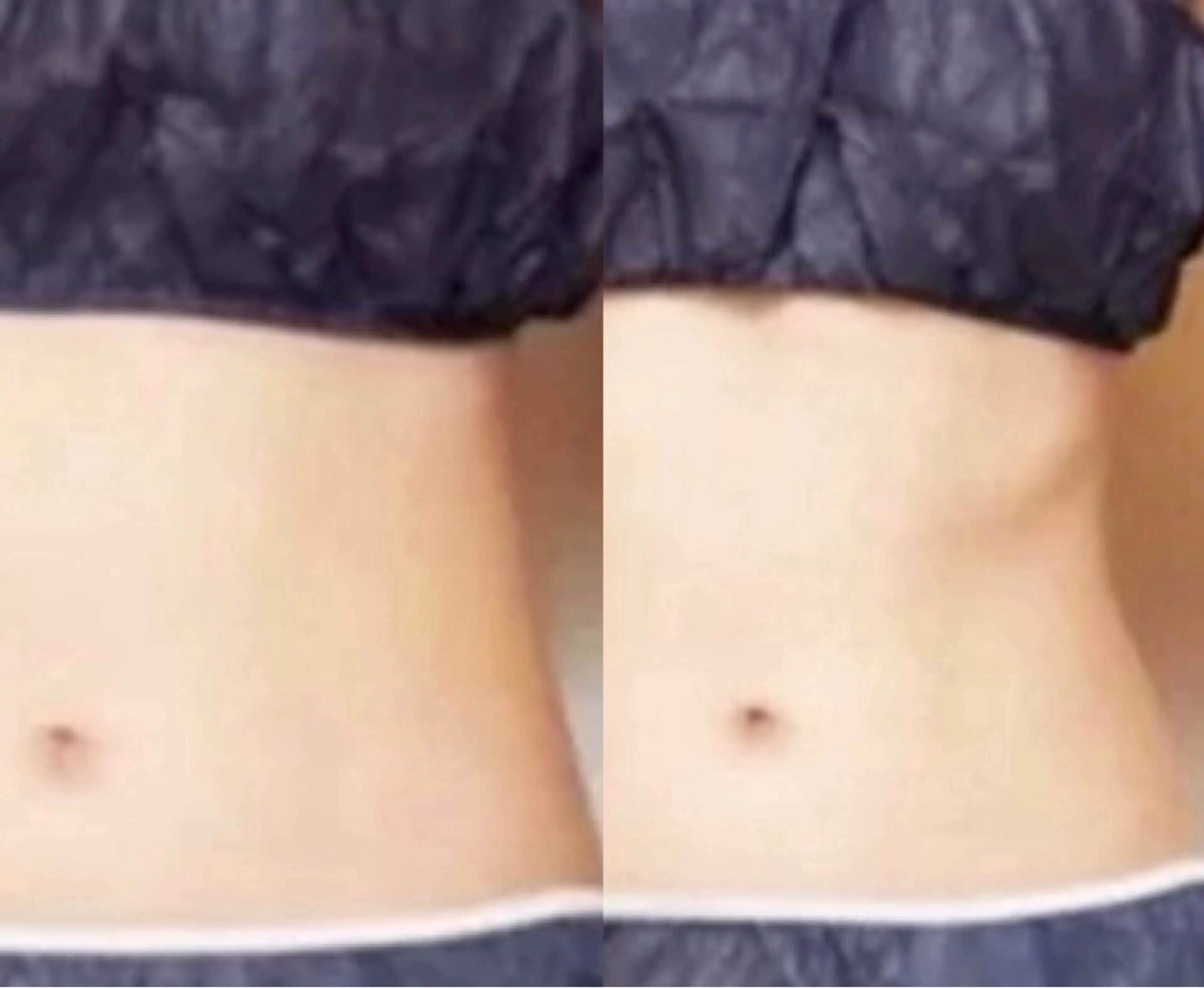 メンズ beauty salonnのエステ・リラクイメージ