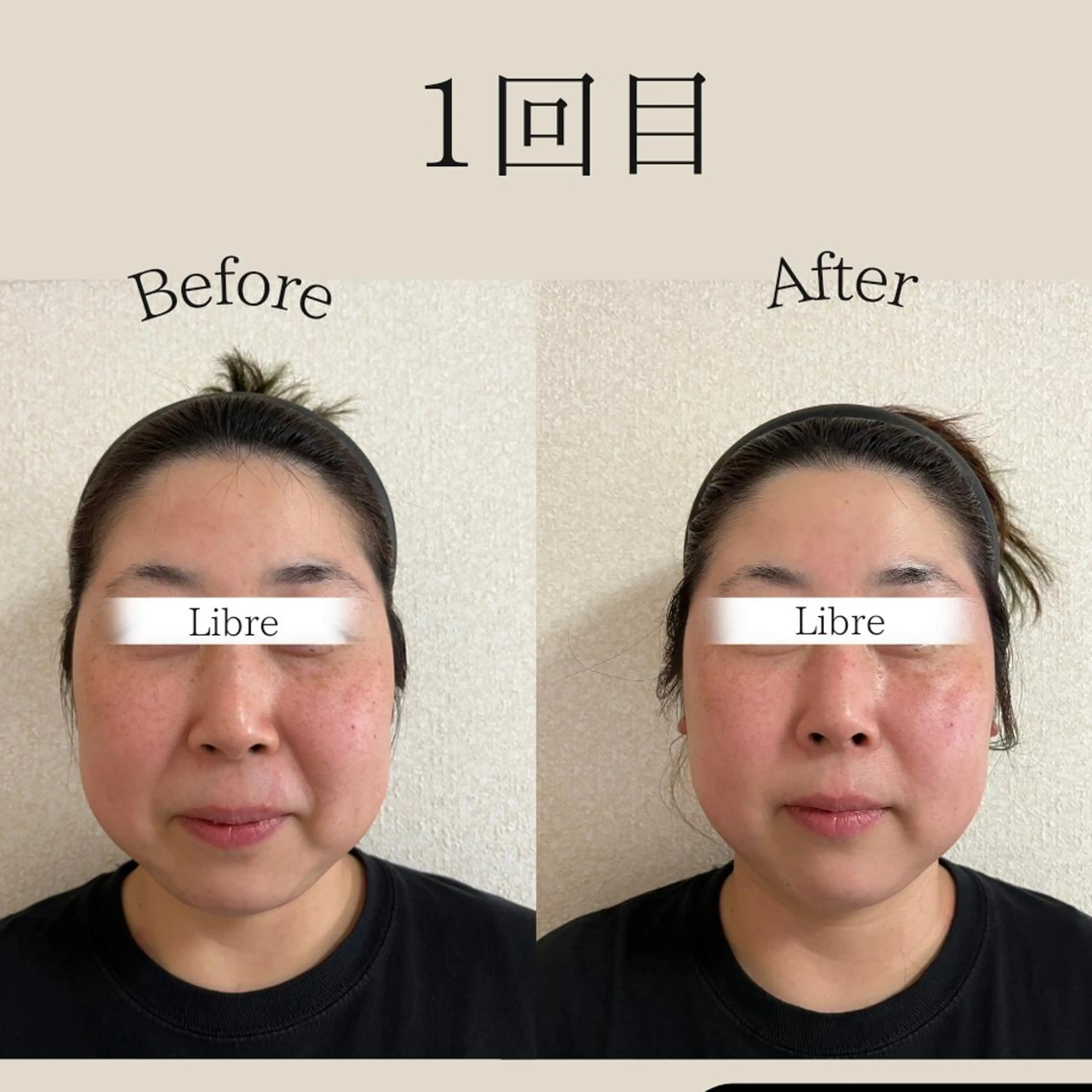 小顔コルギ&肌質改善 の専門店LIBREのエステ・リラクイメージ