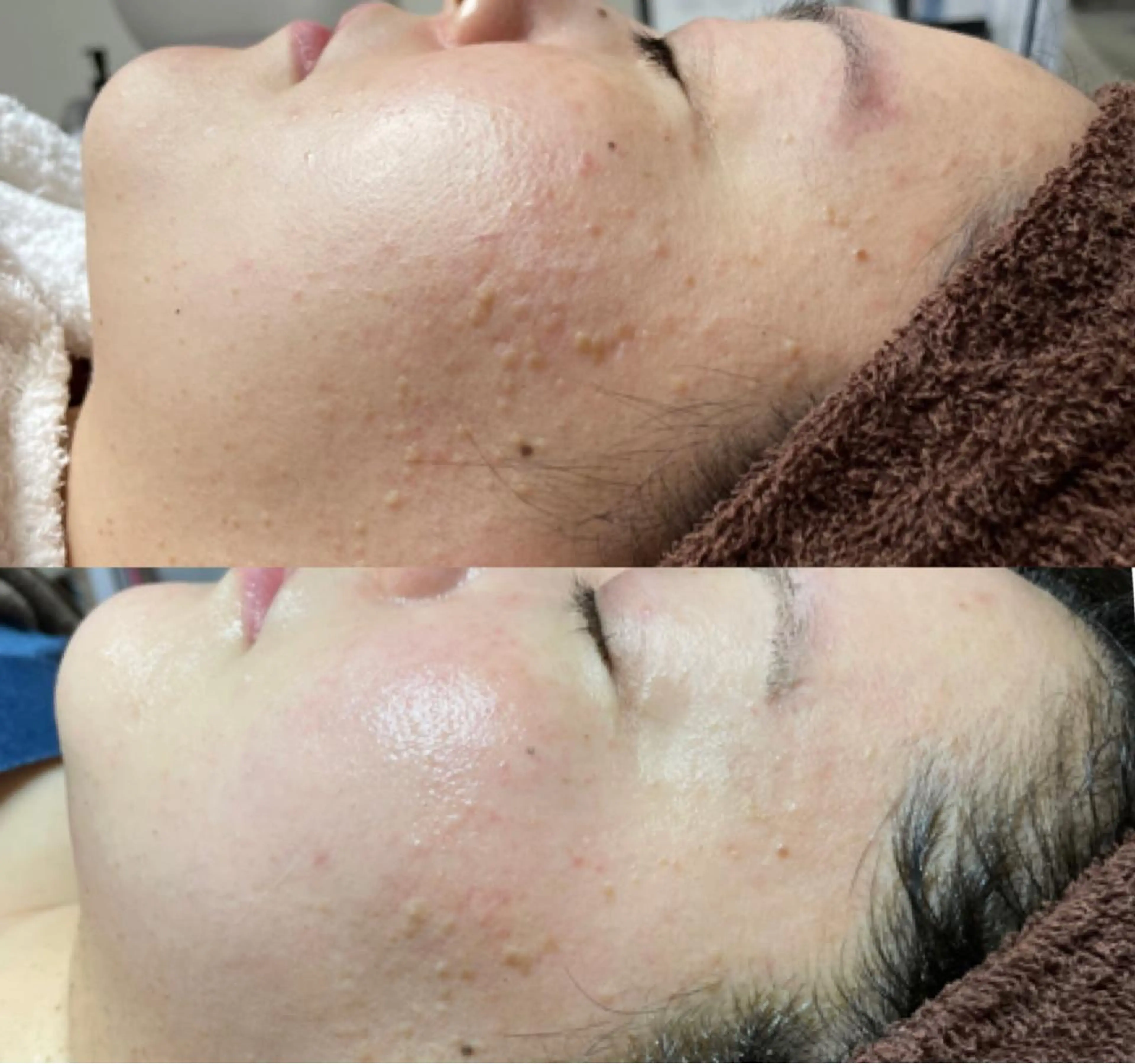 代表 MOMOのエステ・リラクイメージ