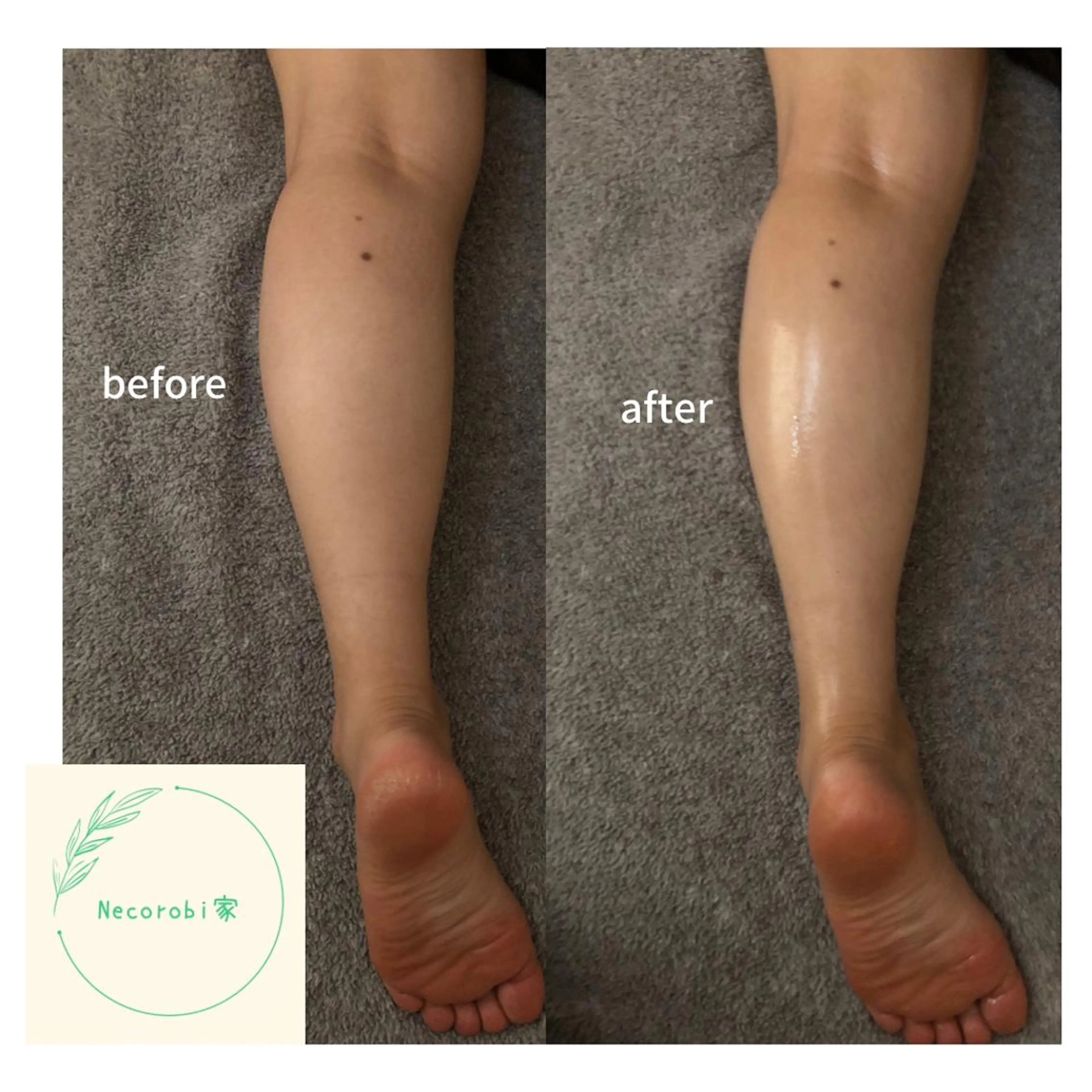 リンパトリートメント90分の写真