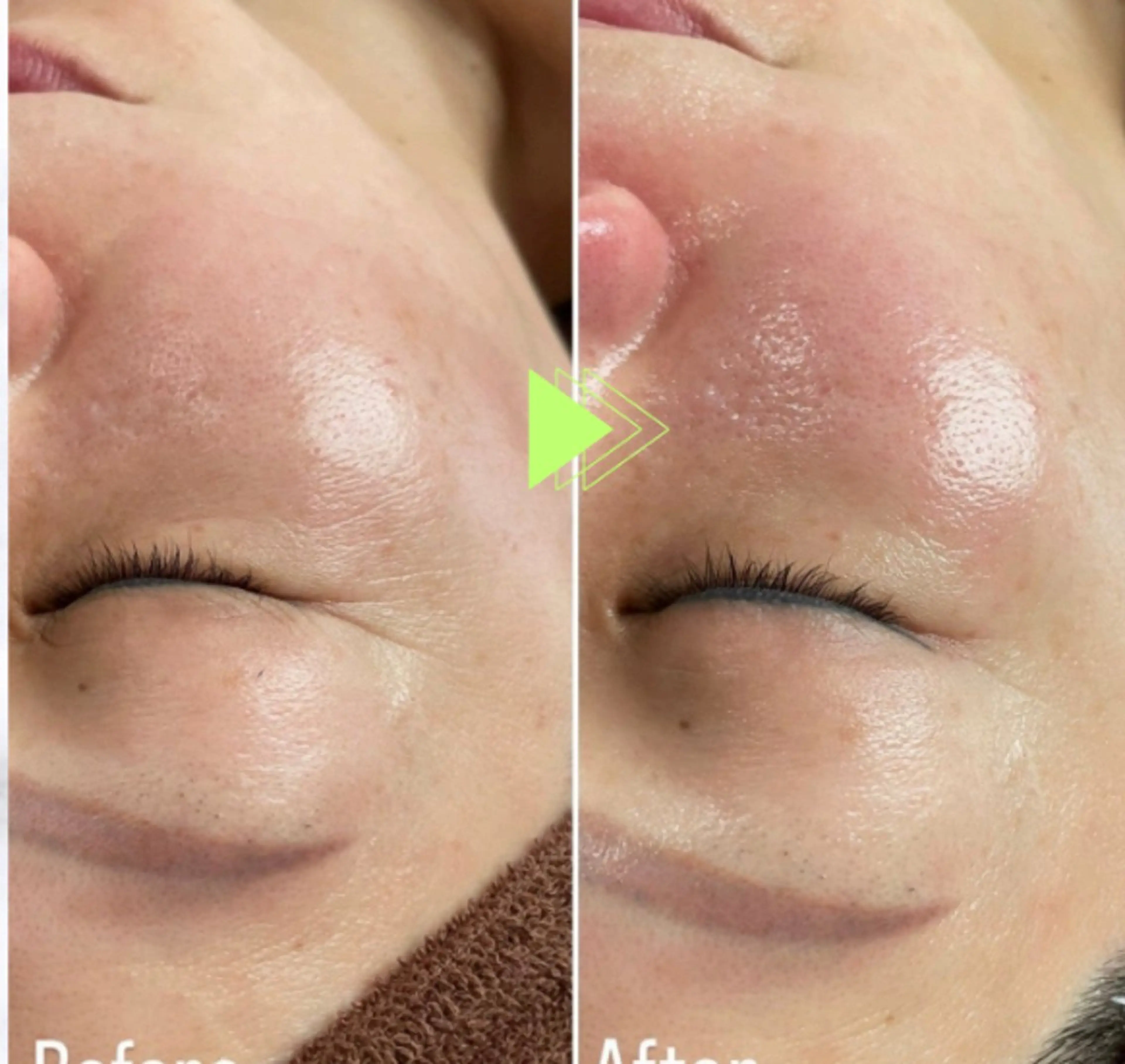 エステ 大名 Kalon（カロン）のエステ・リラクイメージ