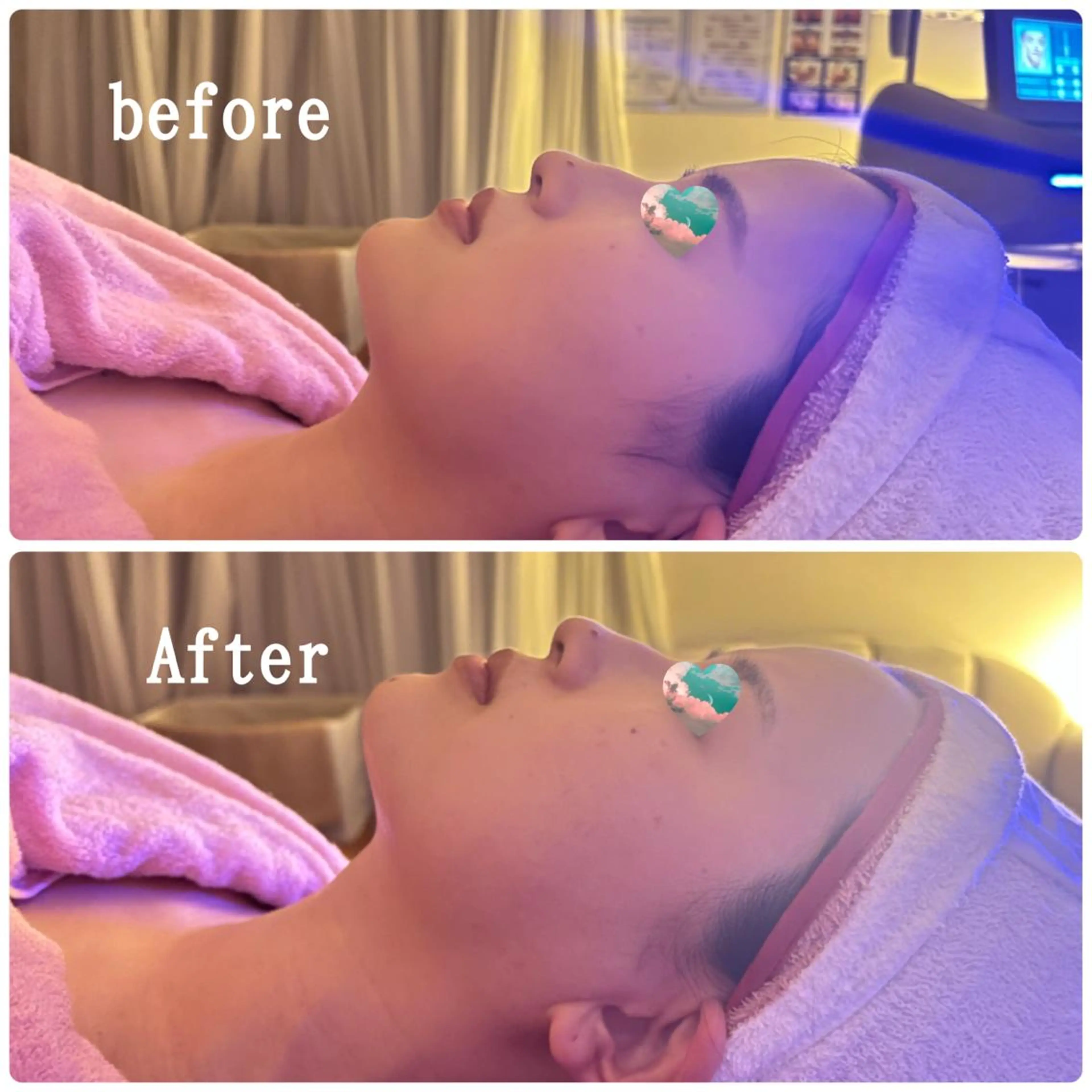 美肌/小顔/眉毛の 専門店 ルミナスのマツエク・マツパデザイン