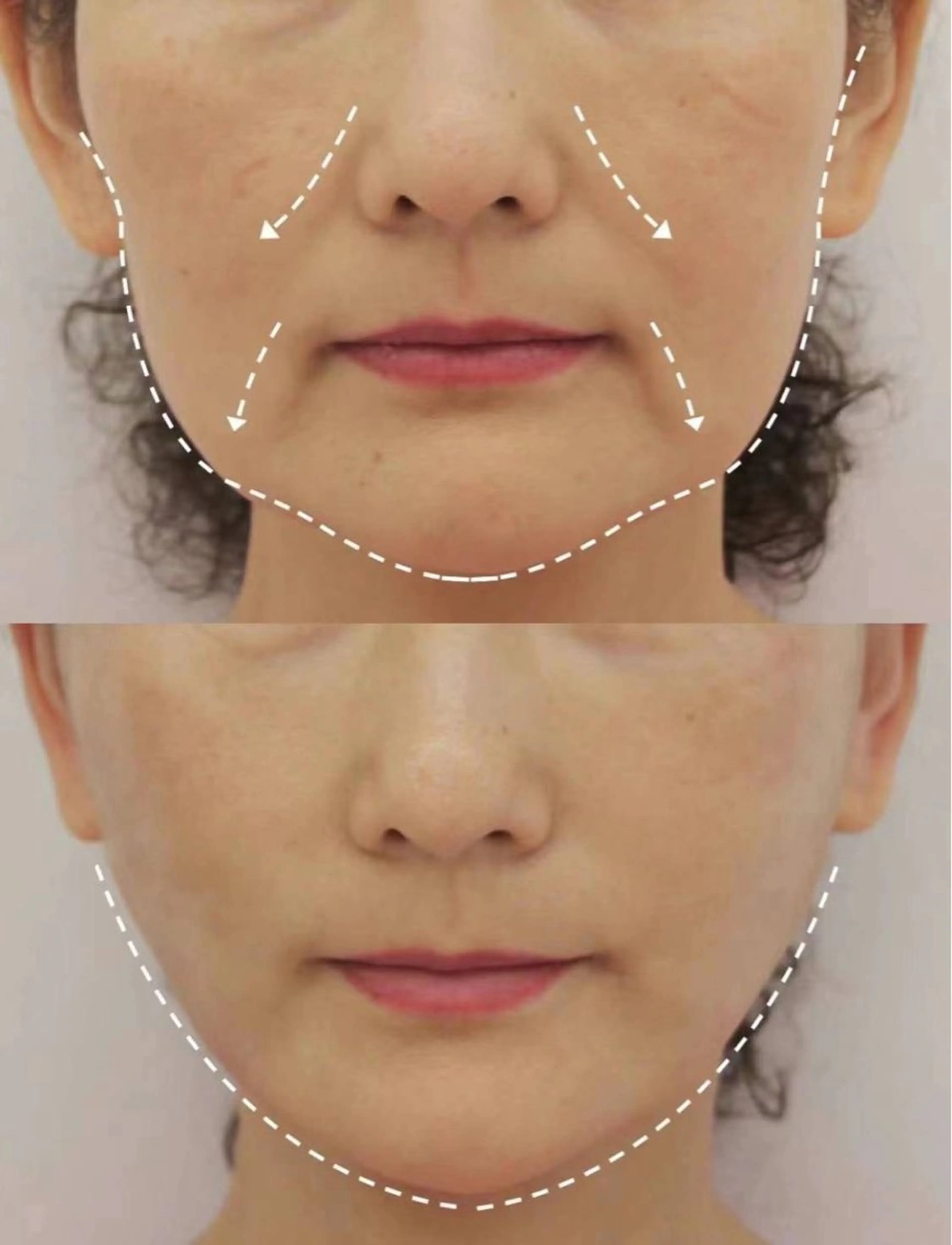 ネイル エステ aliaハイフ&水光ジェットサロン所属・aliaハーブ水光店 エステティシャン募集のエステ・リラクイメージ