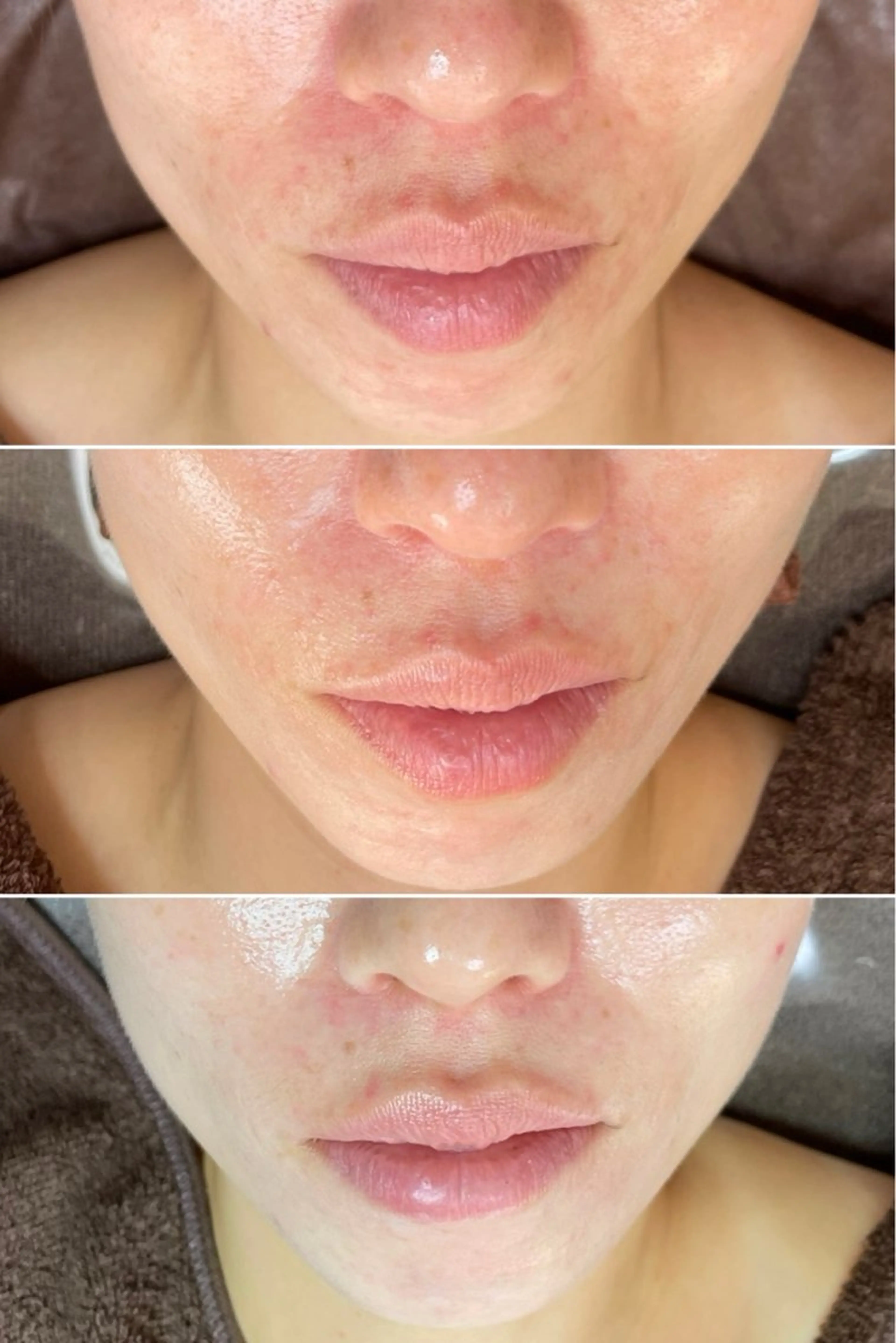 エステ 脱毛和みサロン新茶屋所属・脱毛和みサロン新茶屋 ひろみ（女性専用）のエステ・リラクイメージ