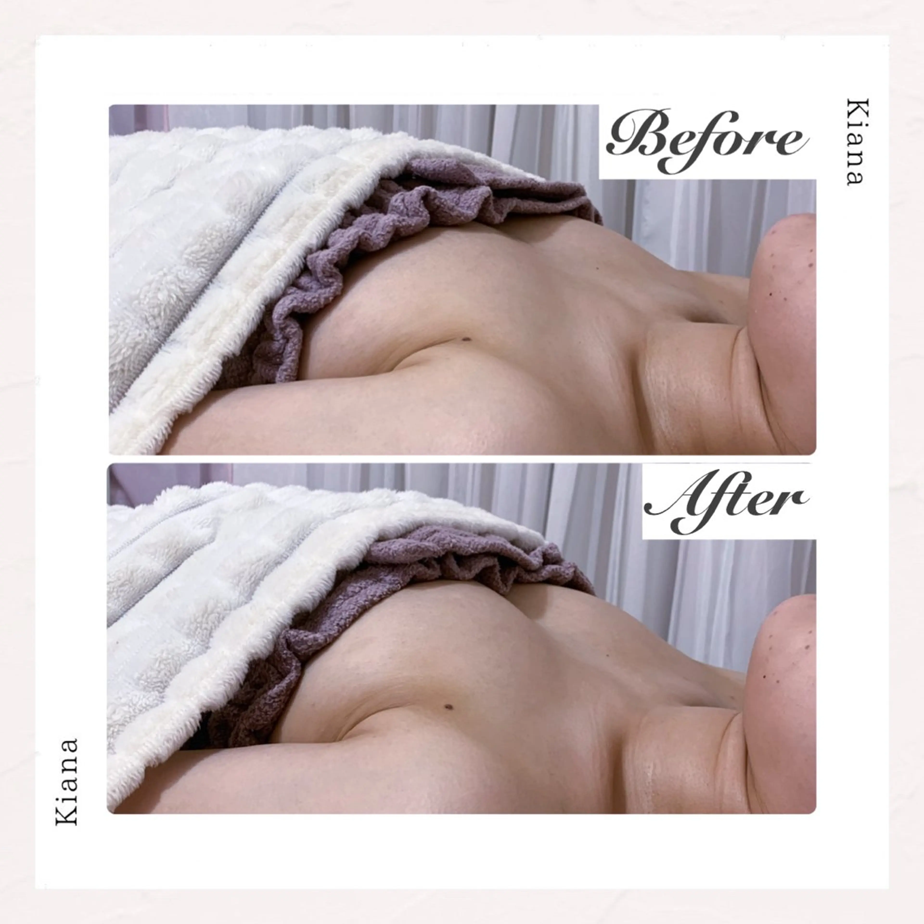 バスト専門Kiana 風のエステ・リラクイメージ