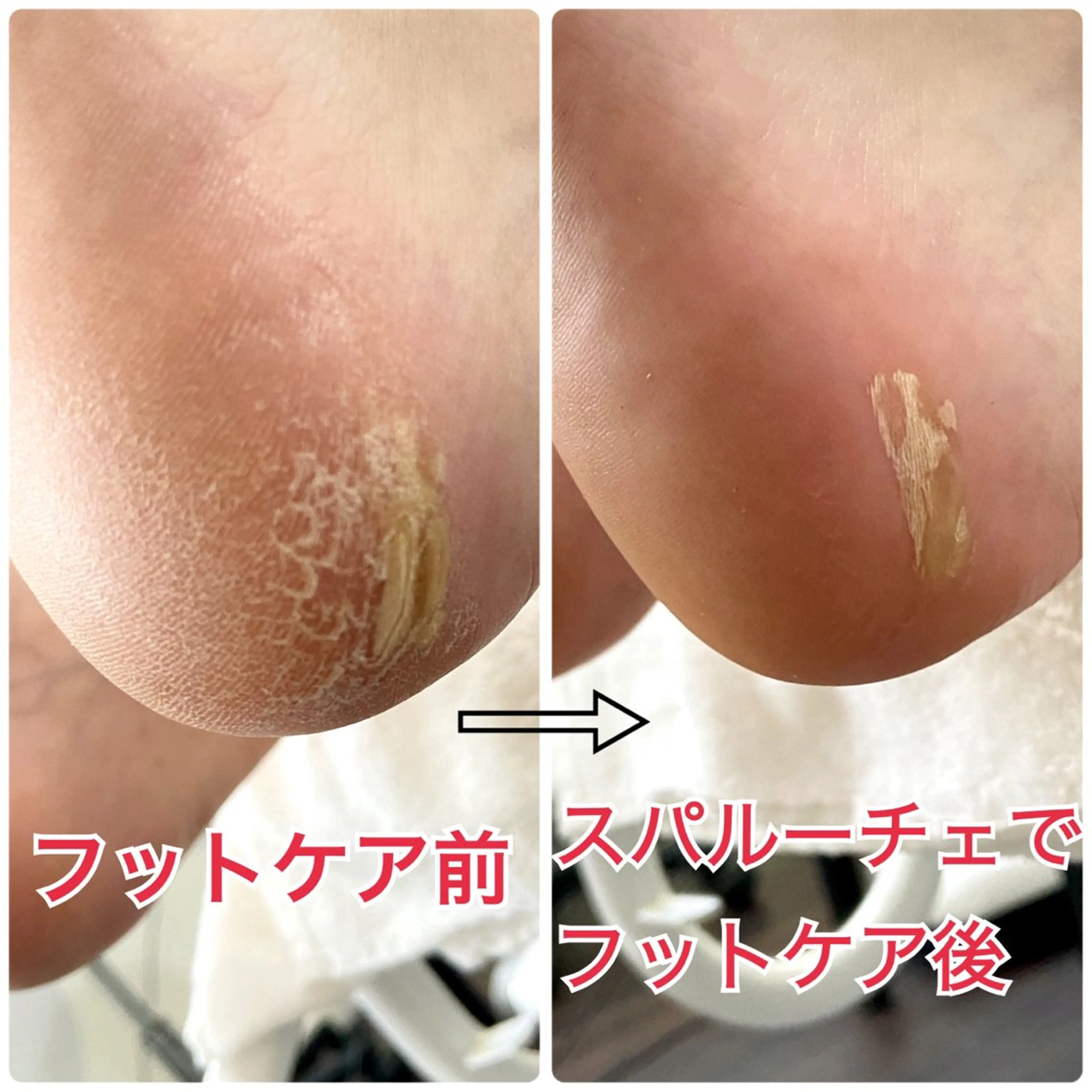 ネイル フットネイル Lotus Nailのネイルデザイン