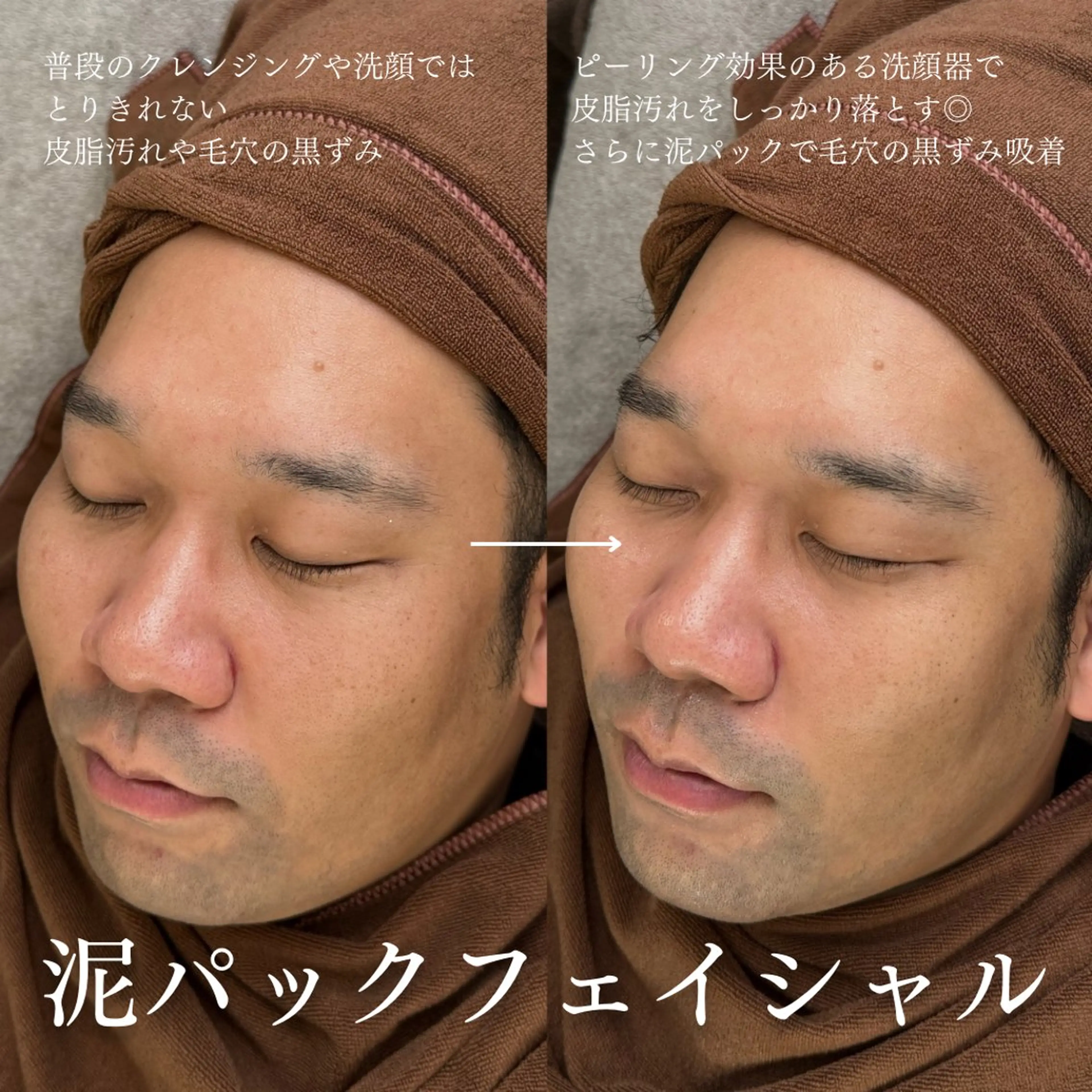 メンズ エステ 眉毛専門サロンeight（エイト）大阪心斎橋所属・今福 しおりの眉毛・アイブロウイメージ