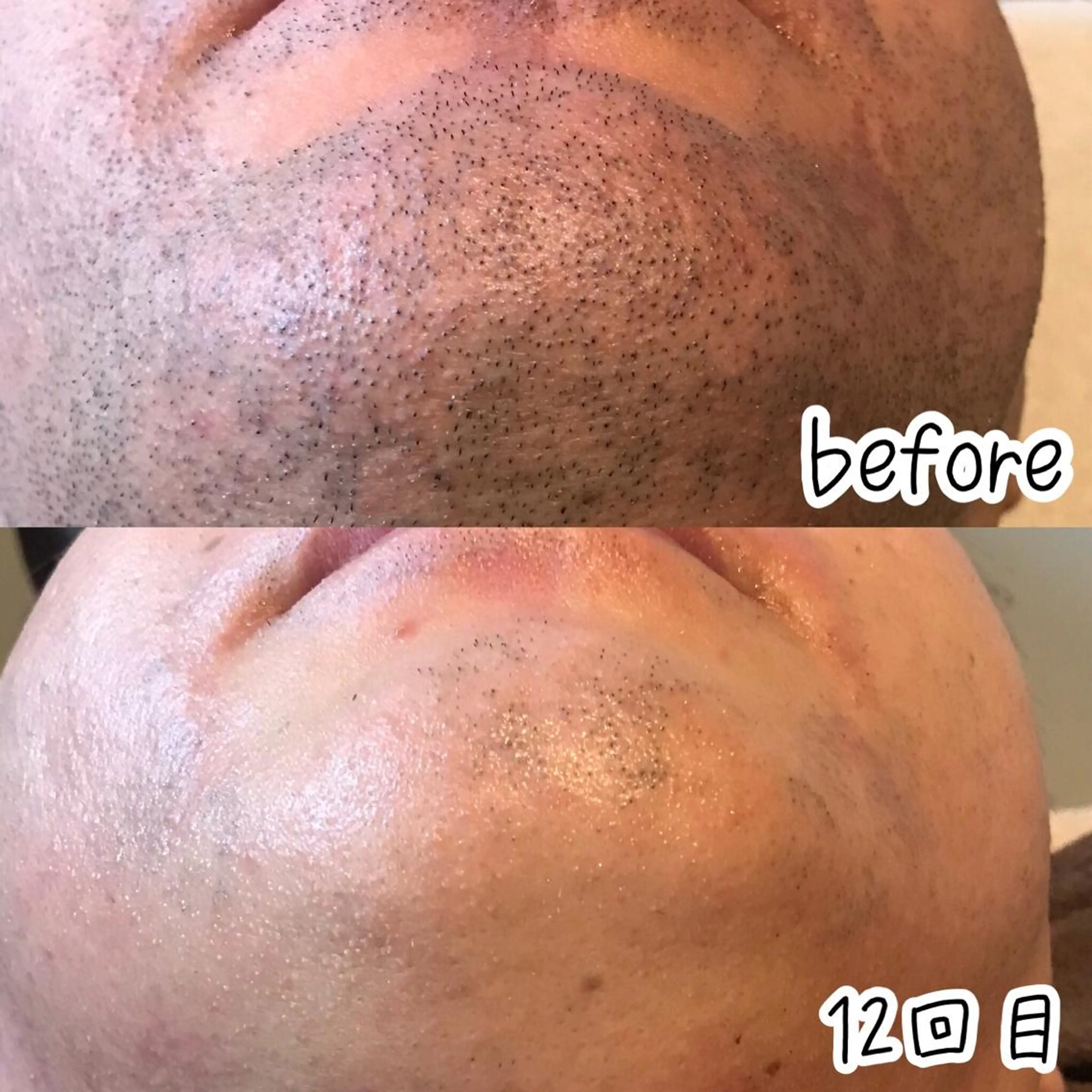 脱毛 浜野 恵美のエステ・リラクイメージ