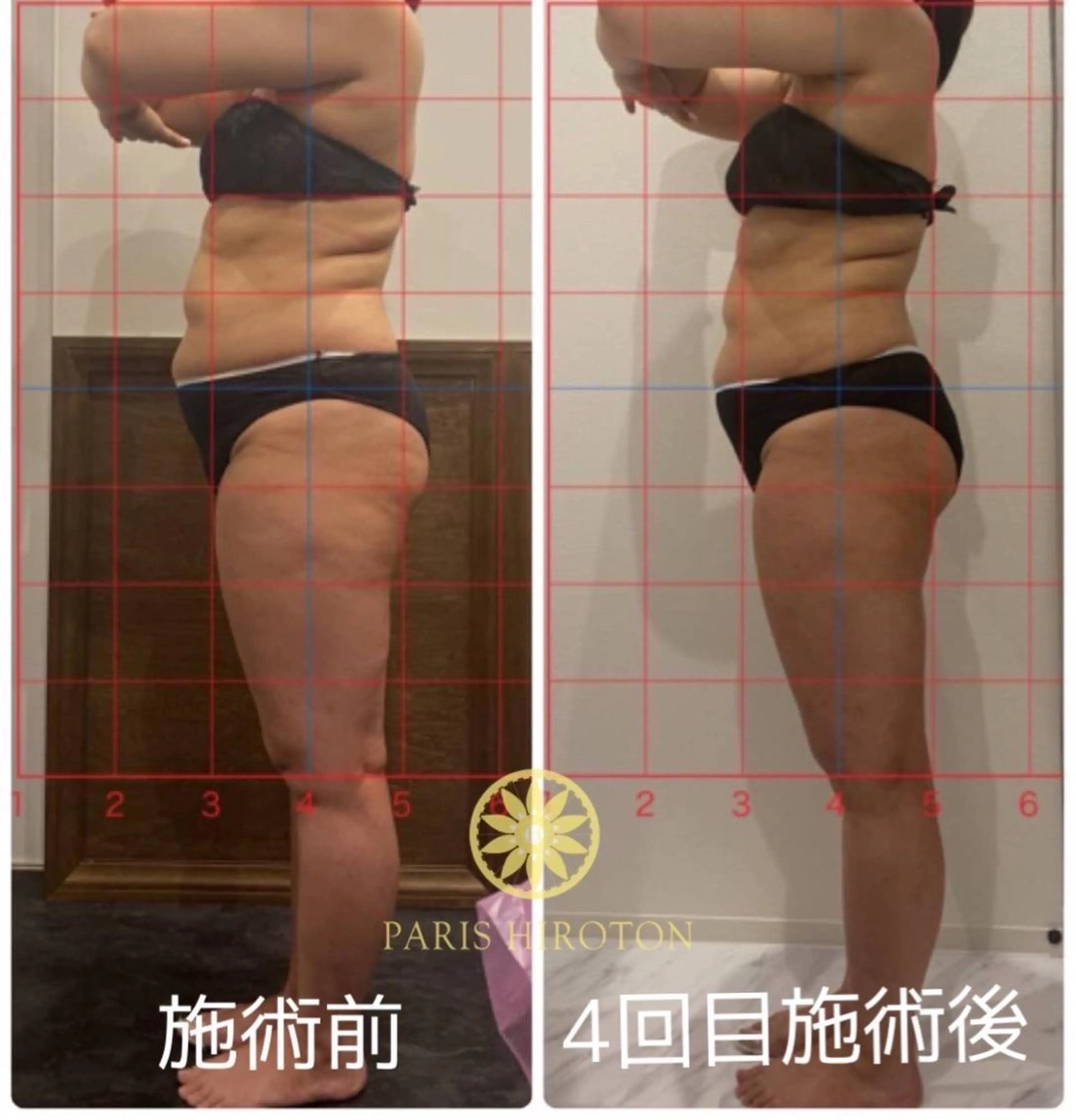 骨盤ダイエット痩身エステサロンBloom所属・坂田 真紀のエステ・リラクイメージ