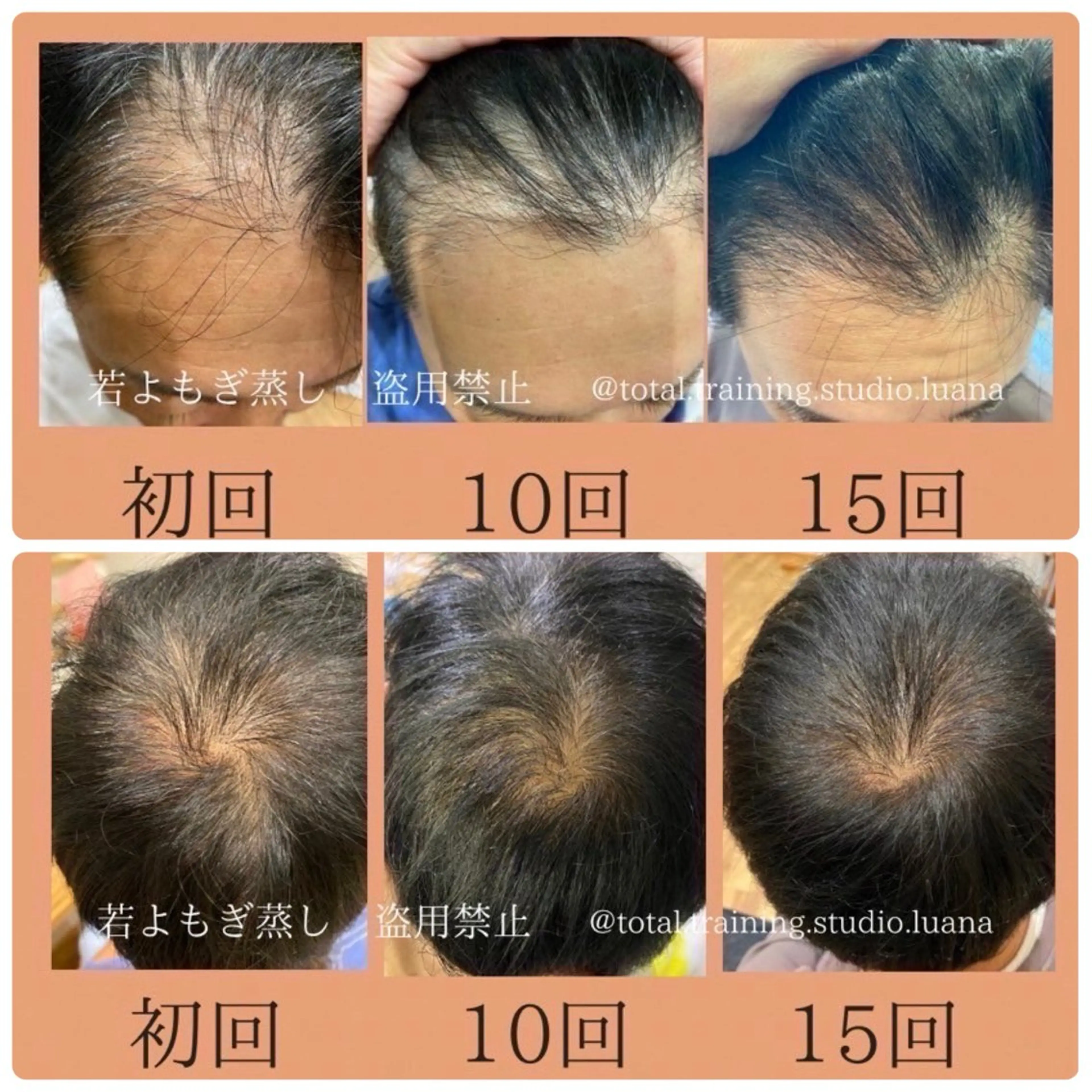 private salon  Dea_maris シュガーリング＆パーソナルボディケア所属・シミ改善・韓国肌管理 ボディメイク痩身のその他イメージ