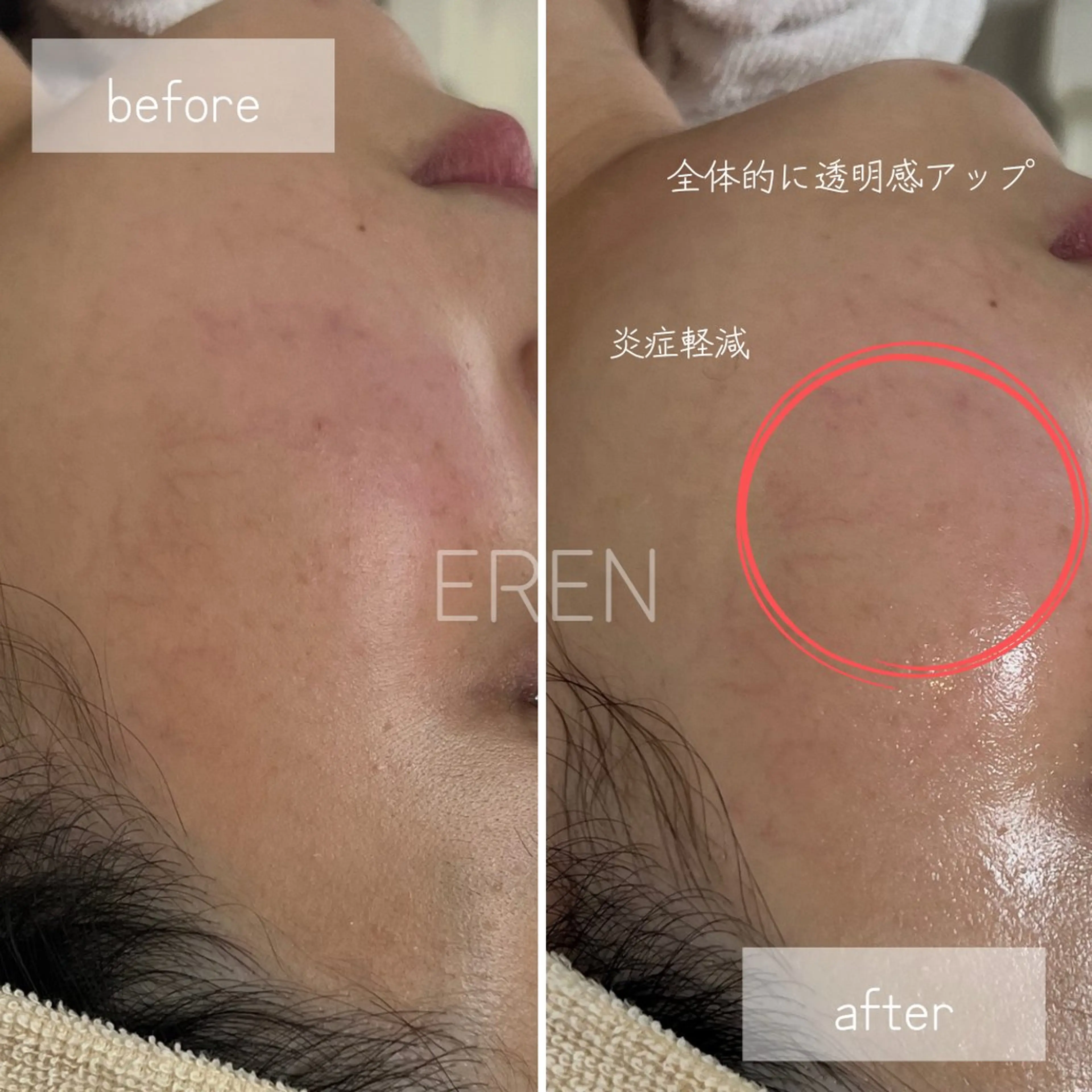 【美肌育成サロン】 エレンのエステ・リラクイメージ